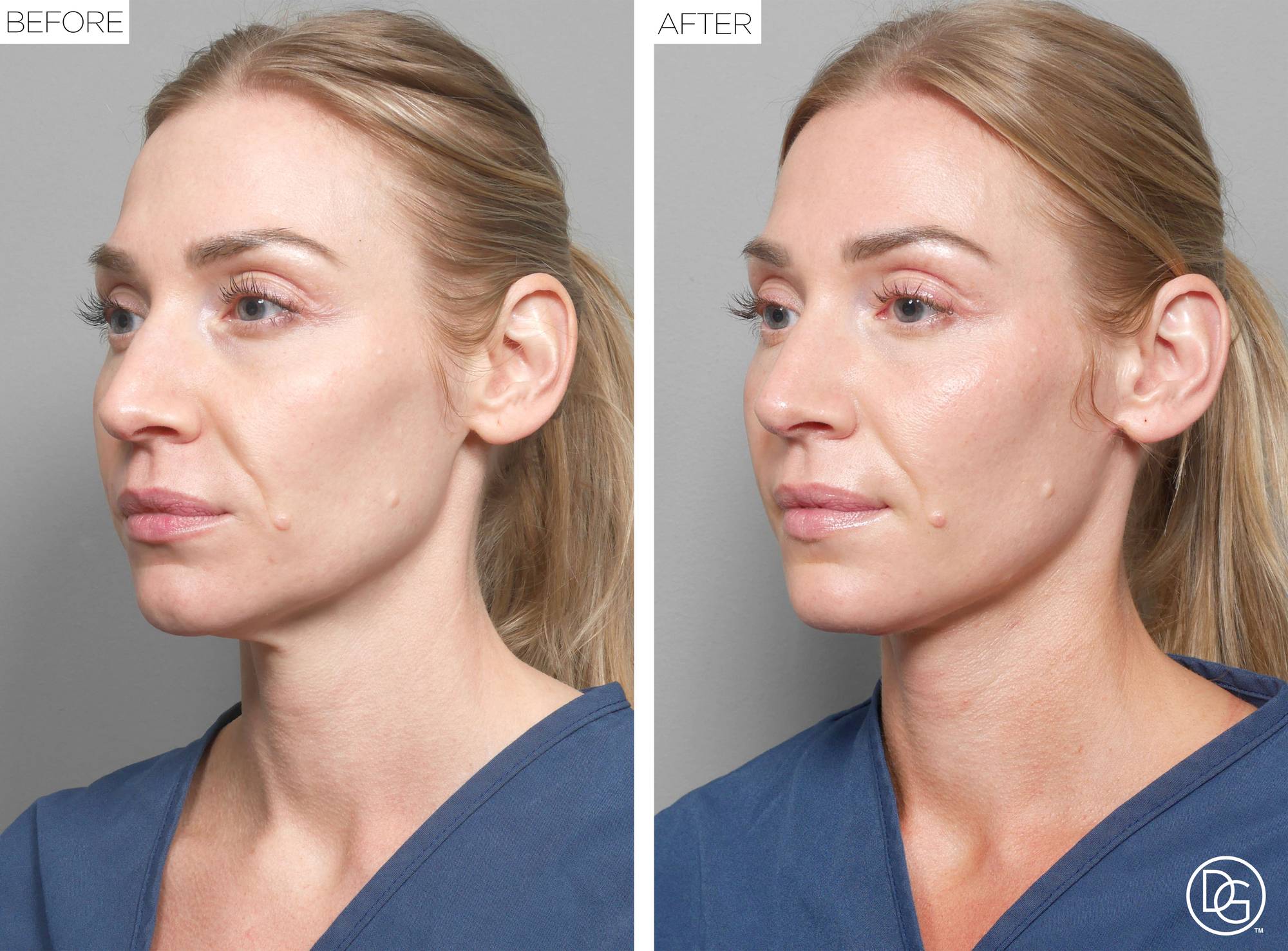 Before & After Image