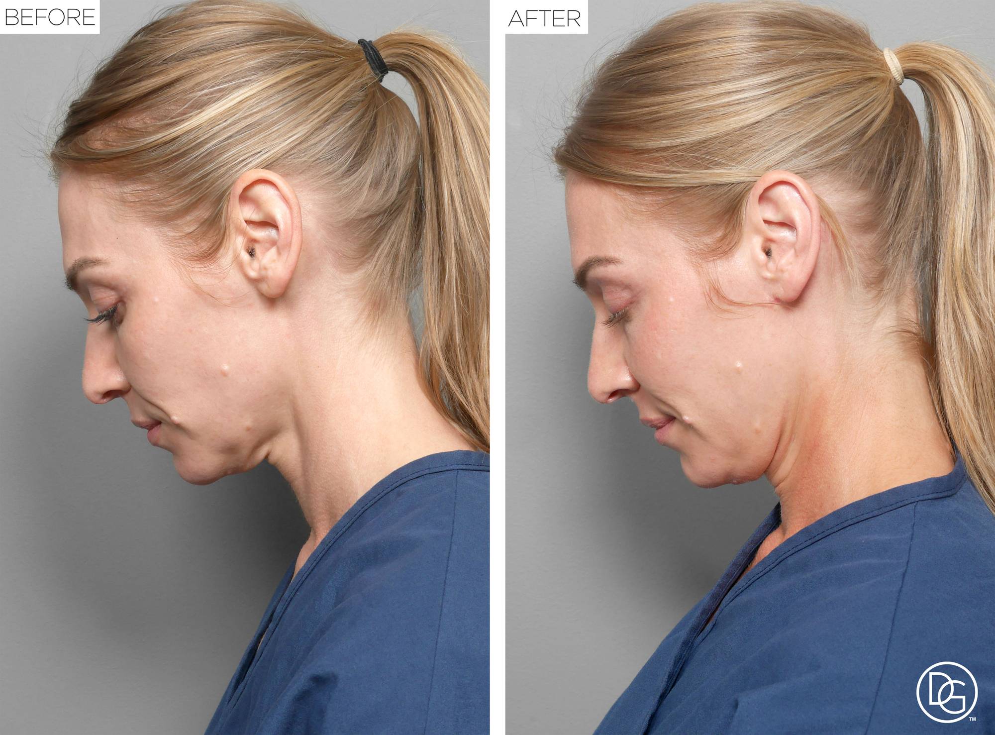 Before & After Image
