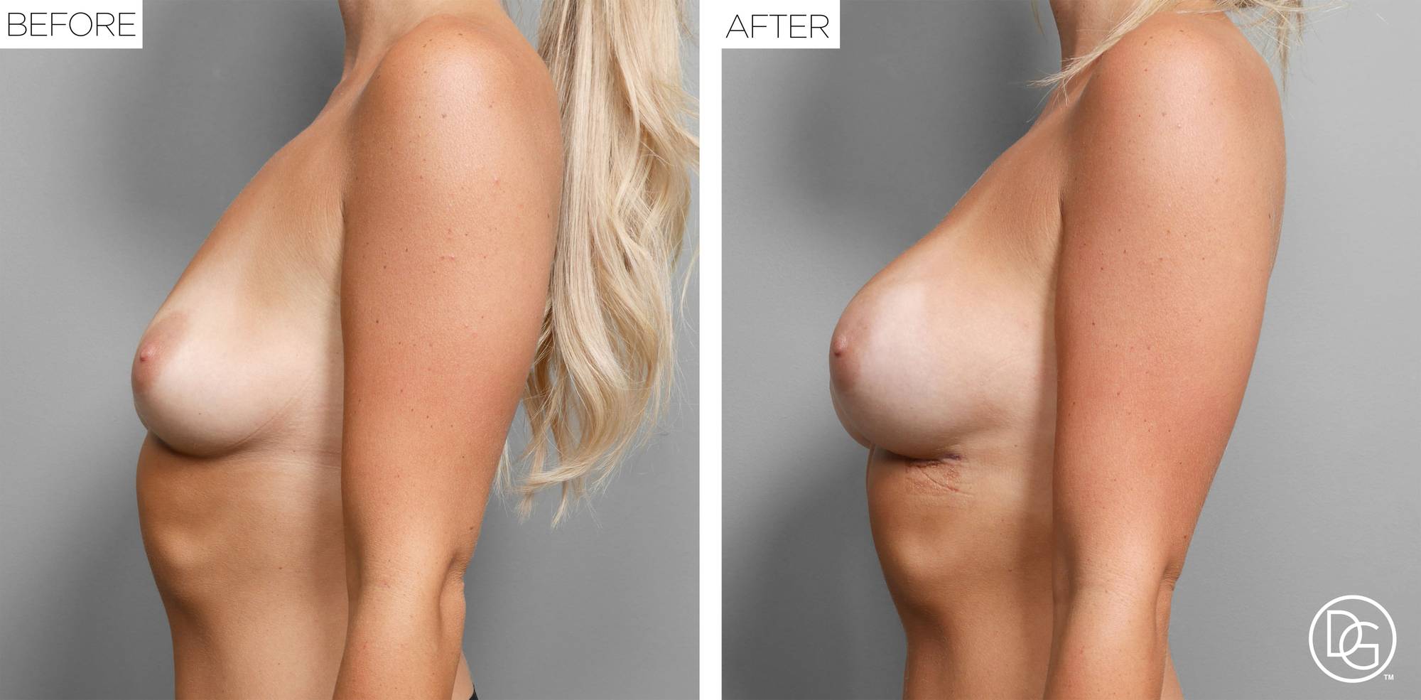 Before & After Image