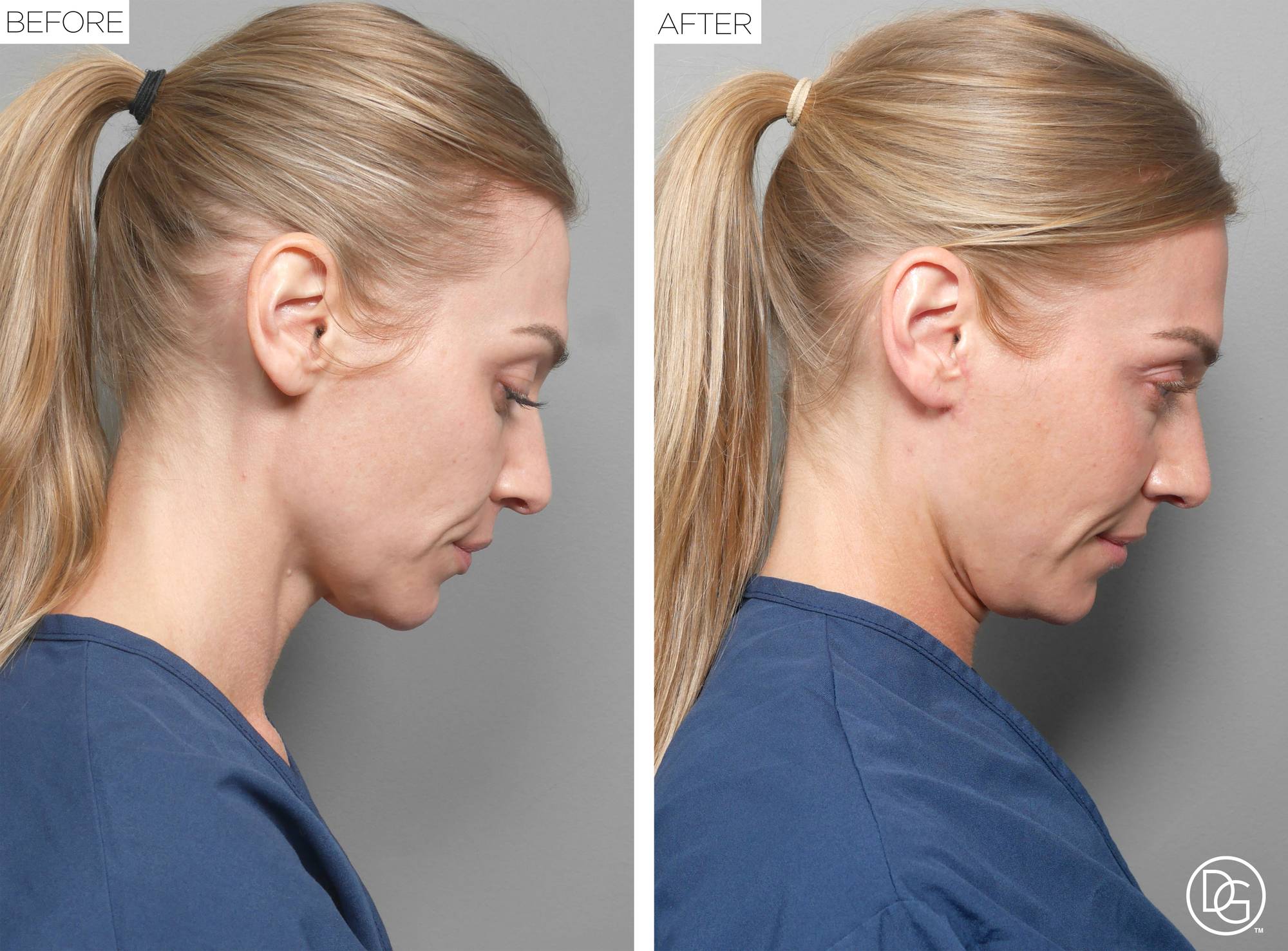 Before & After Image