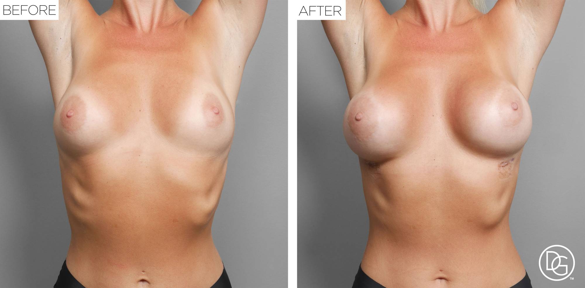 Before & After Image