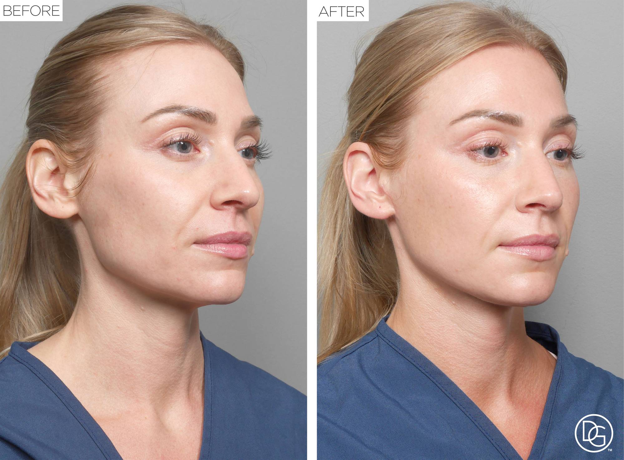 Before & After Image