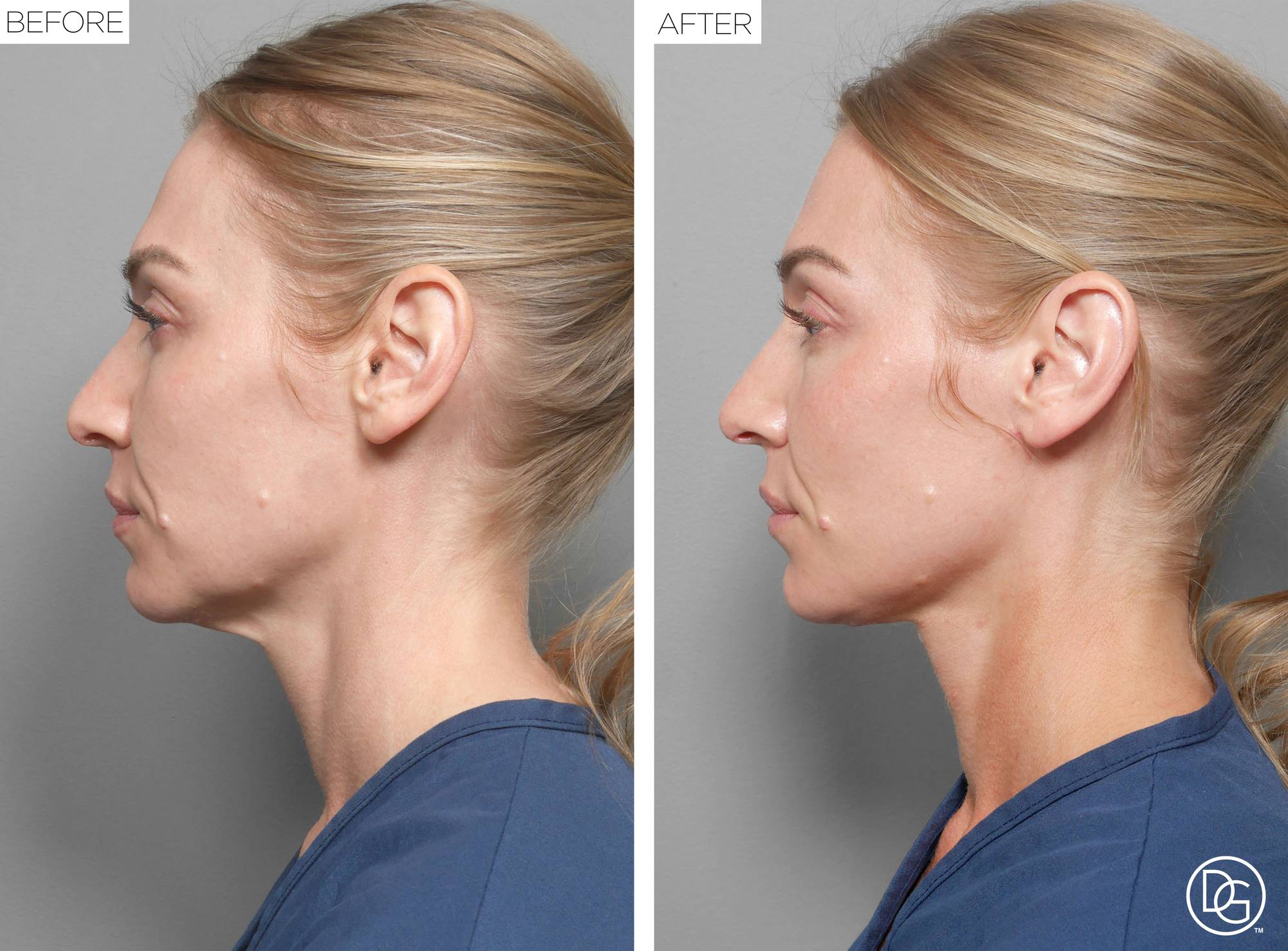 Before & After Image