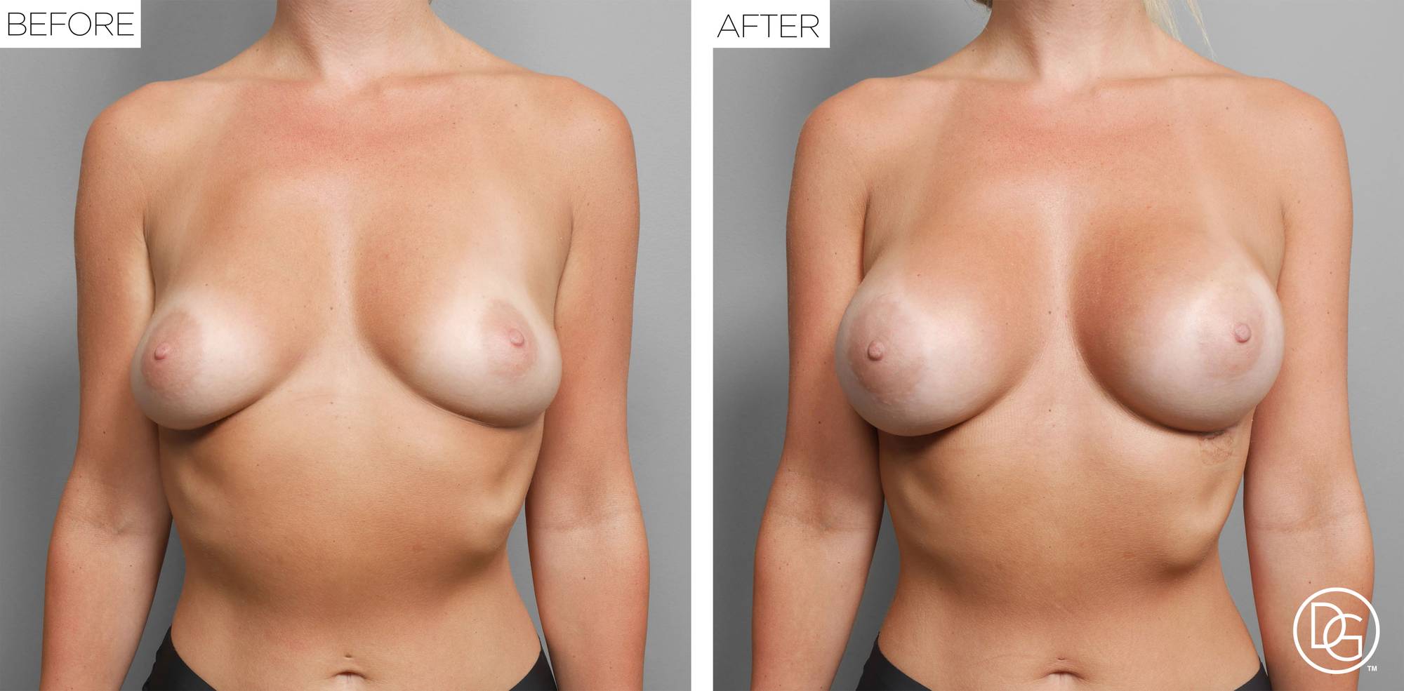 Before & After Image