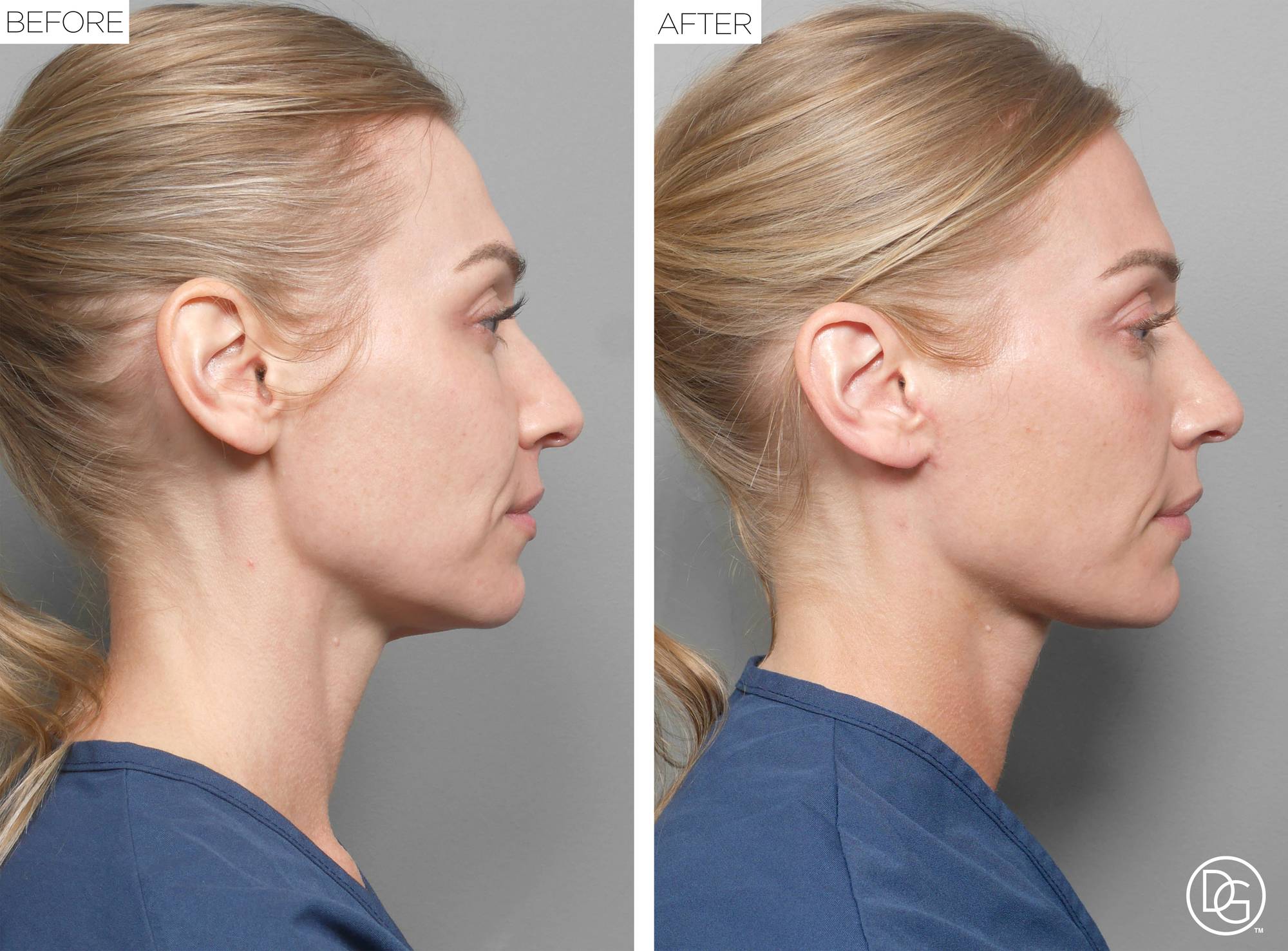 Before & After Image