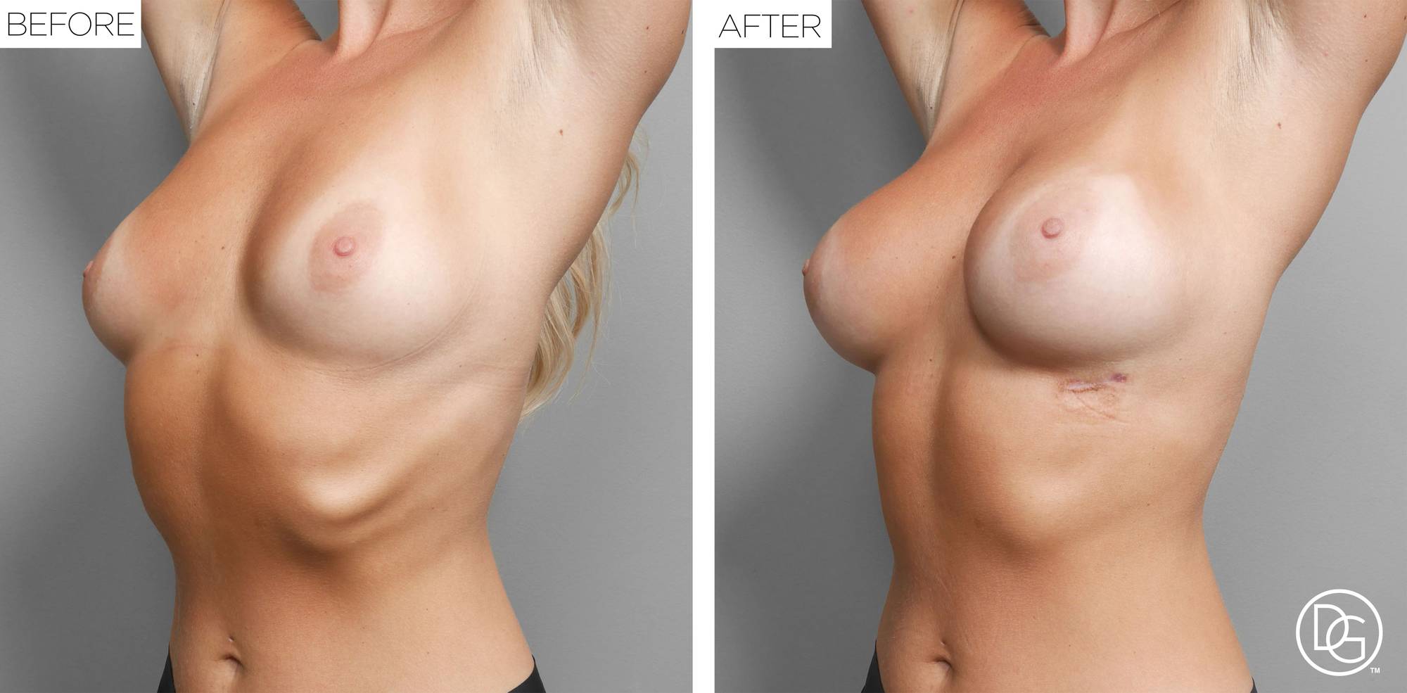 Before & After Image