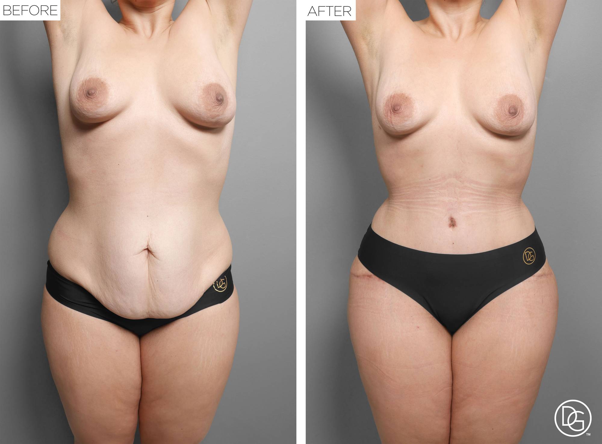 Before & After Image