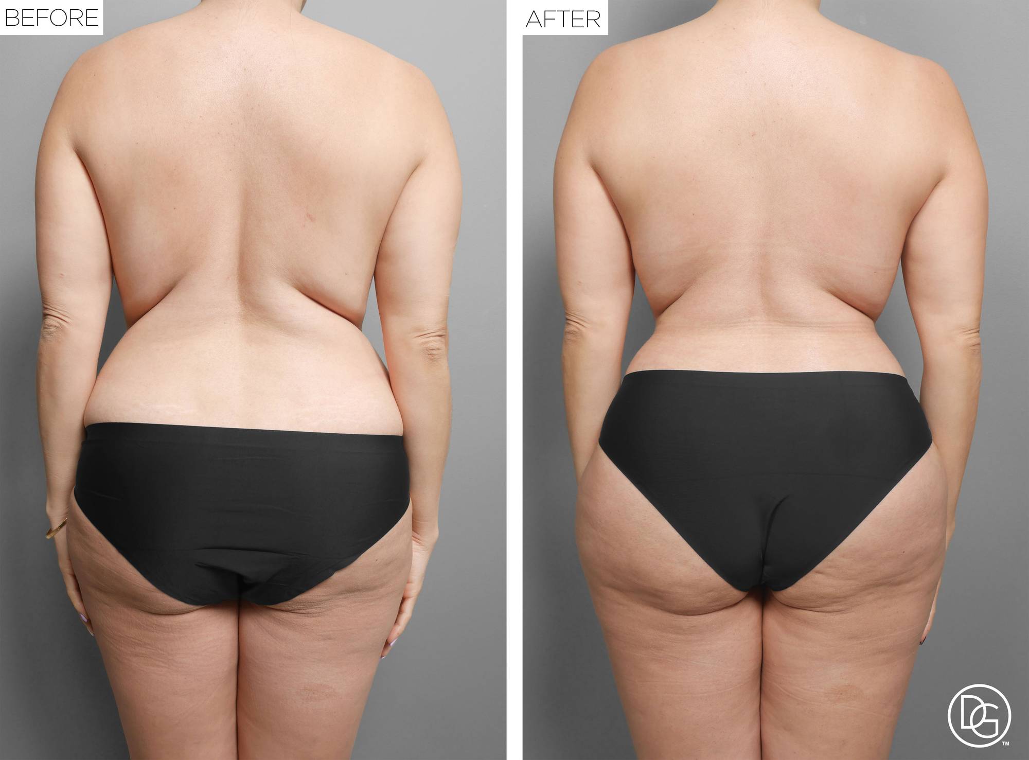 Before & After Image