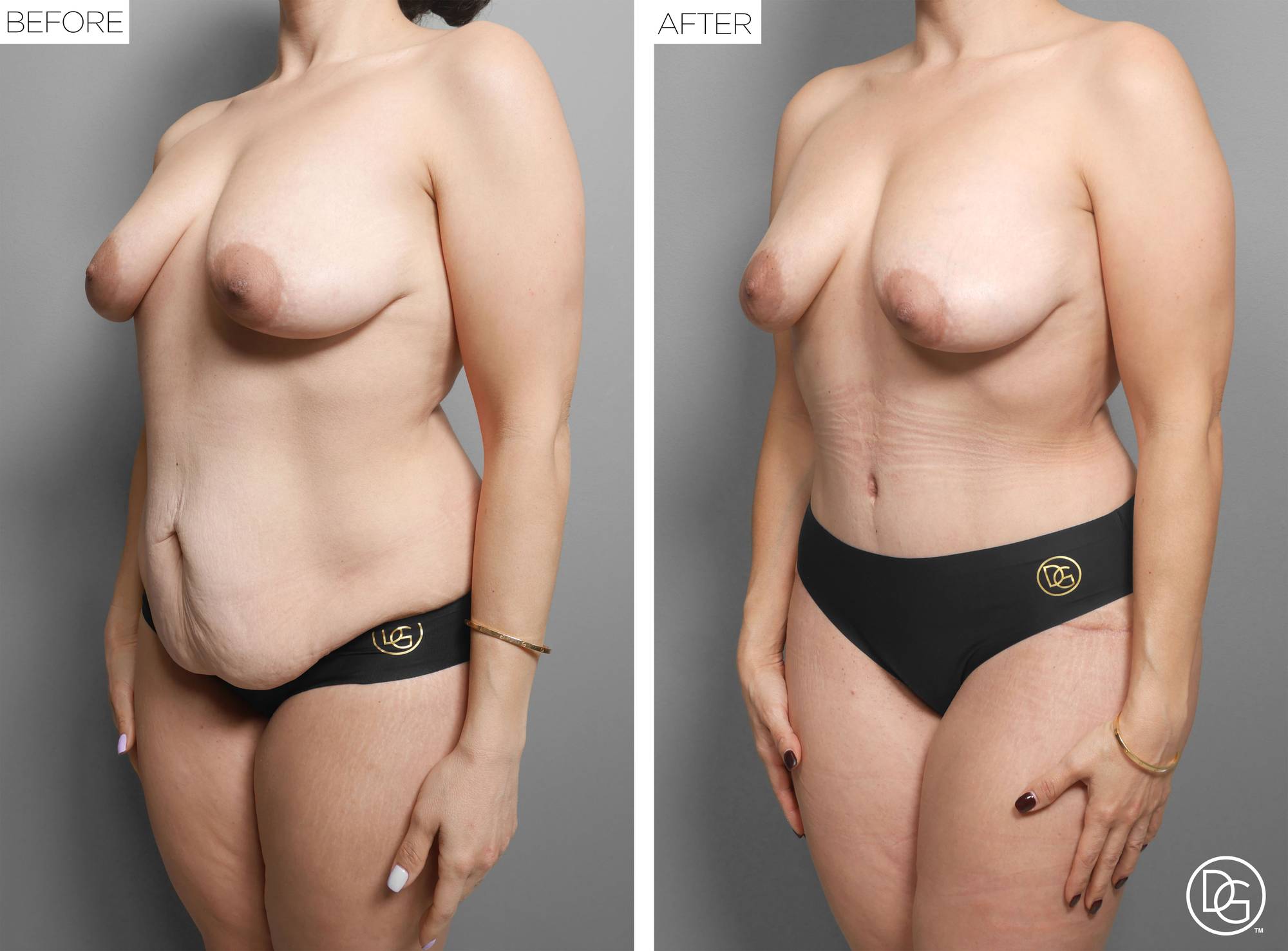 Before & After Image