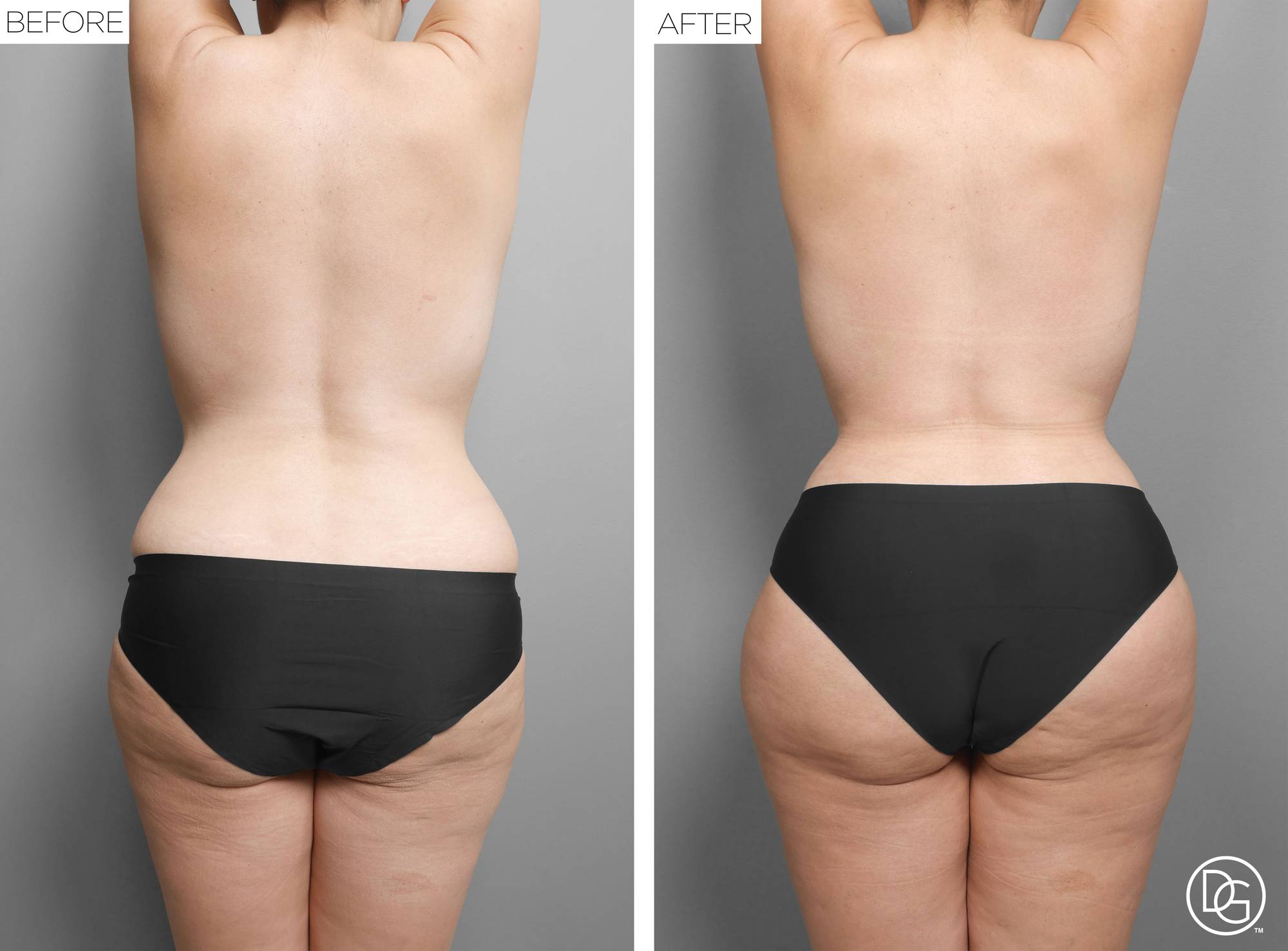 Before & After Image