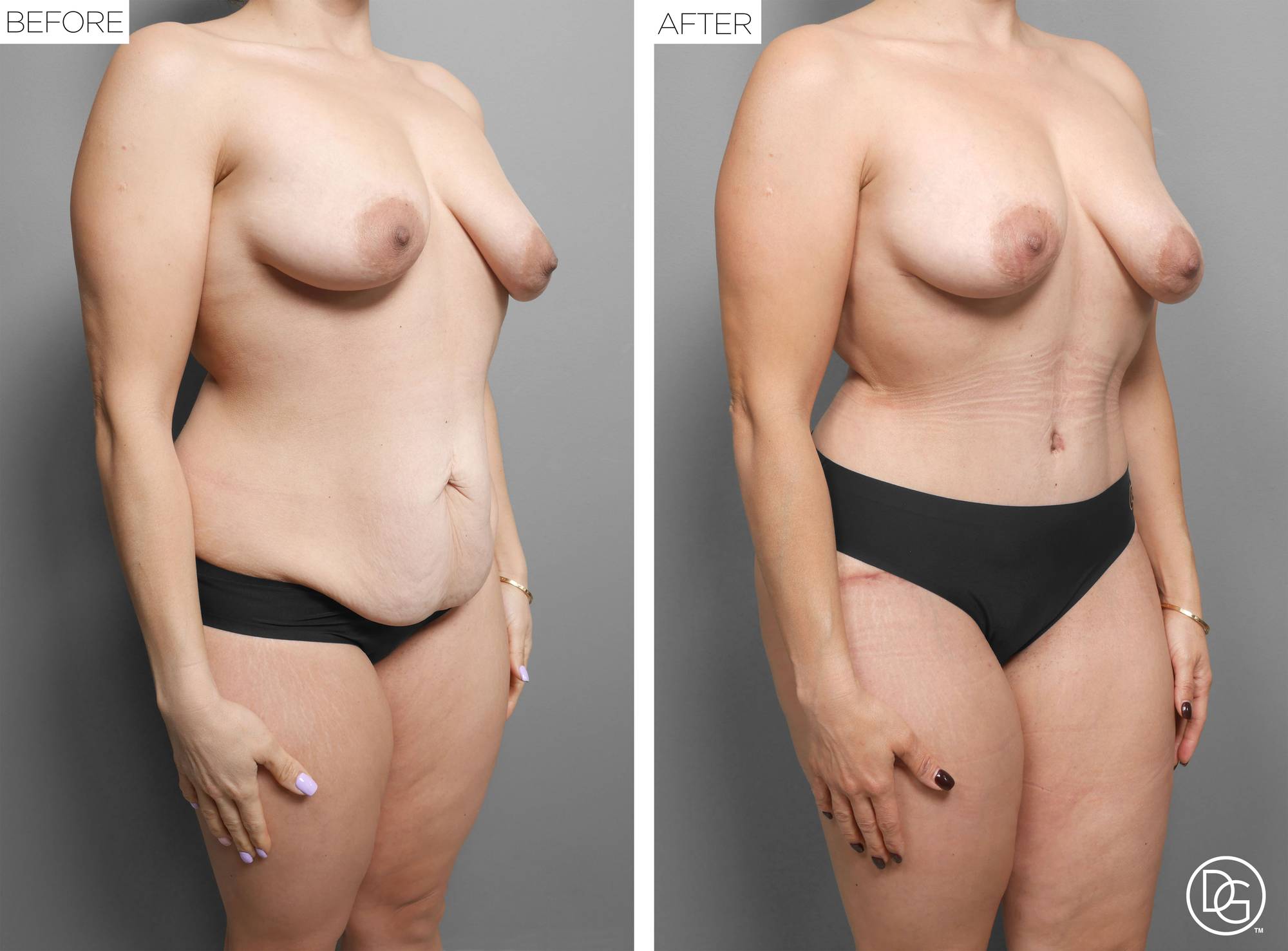 Before & After Image