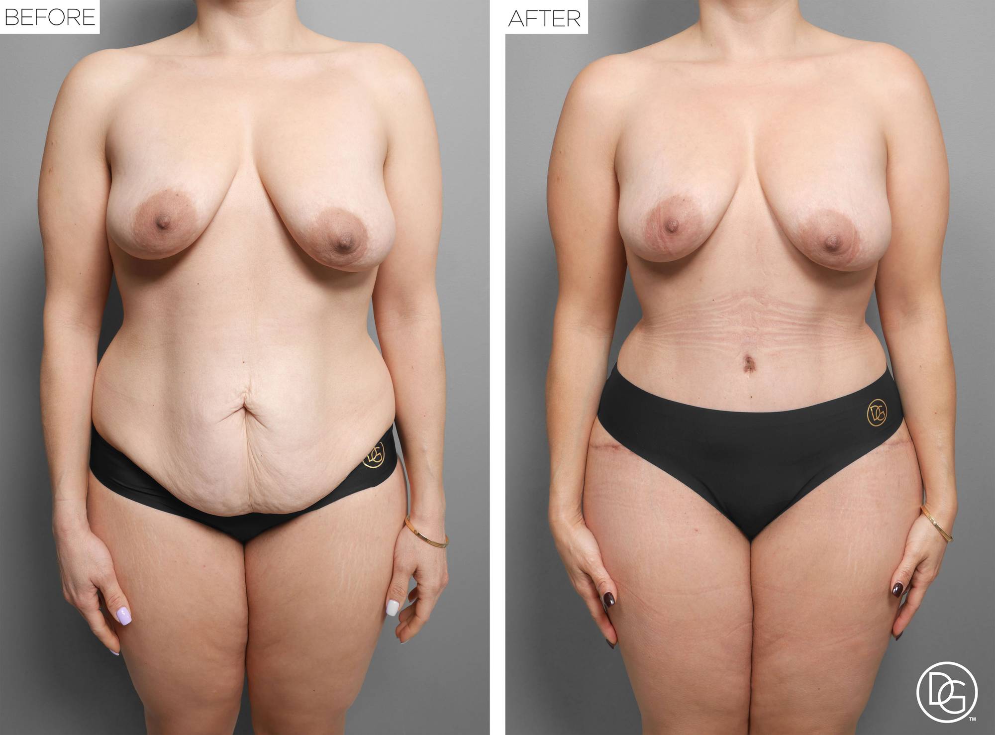 Before & After Image