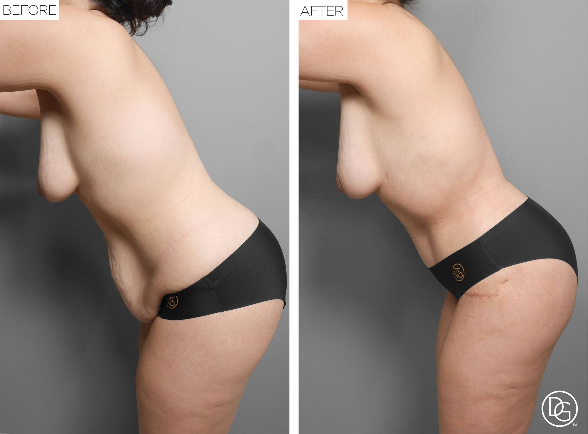 Before & After Image