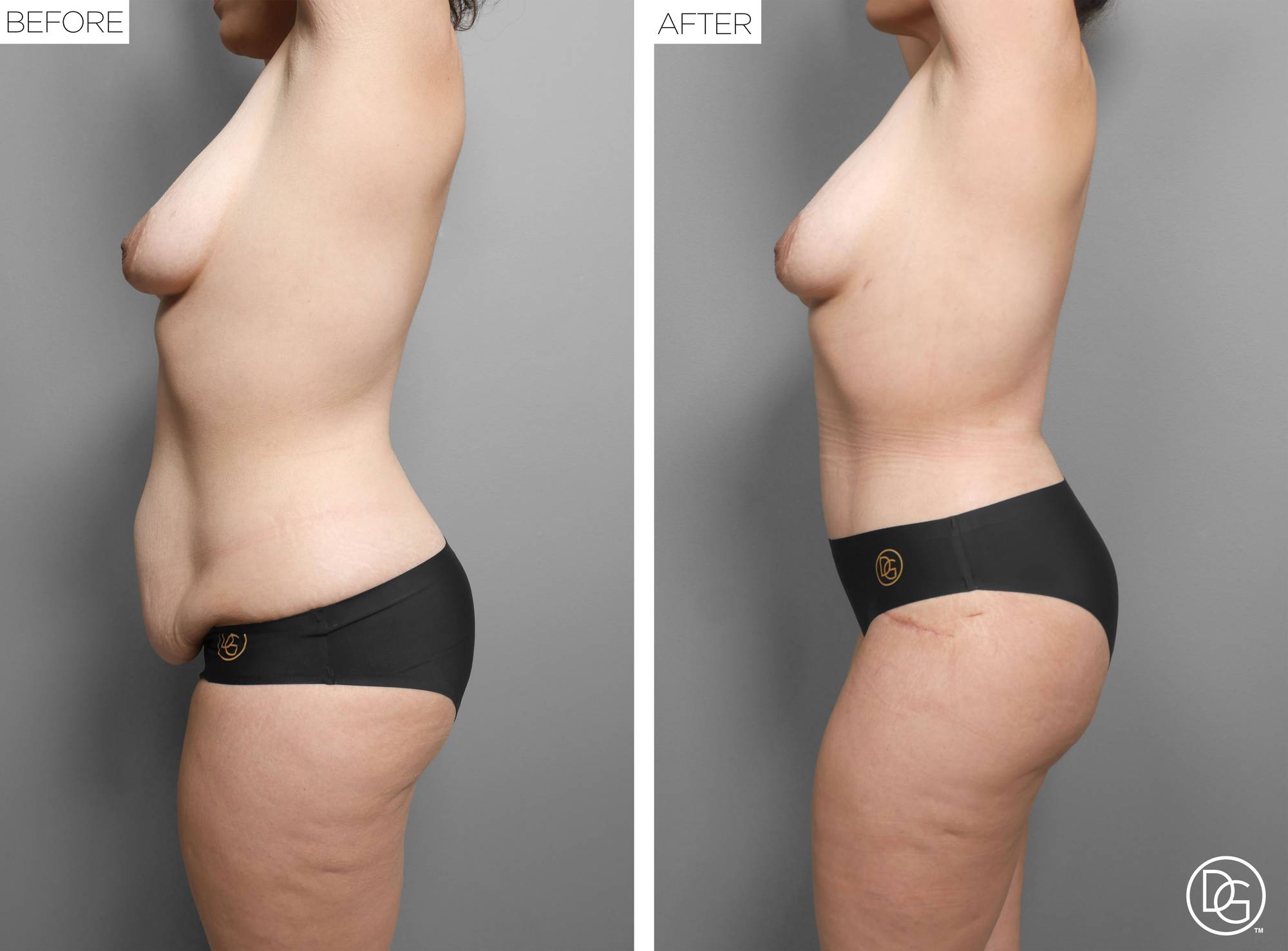 Before & After Image