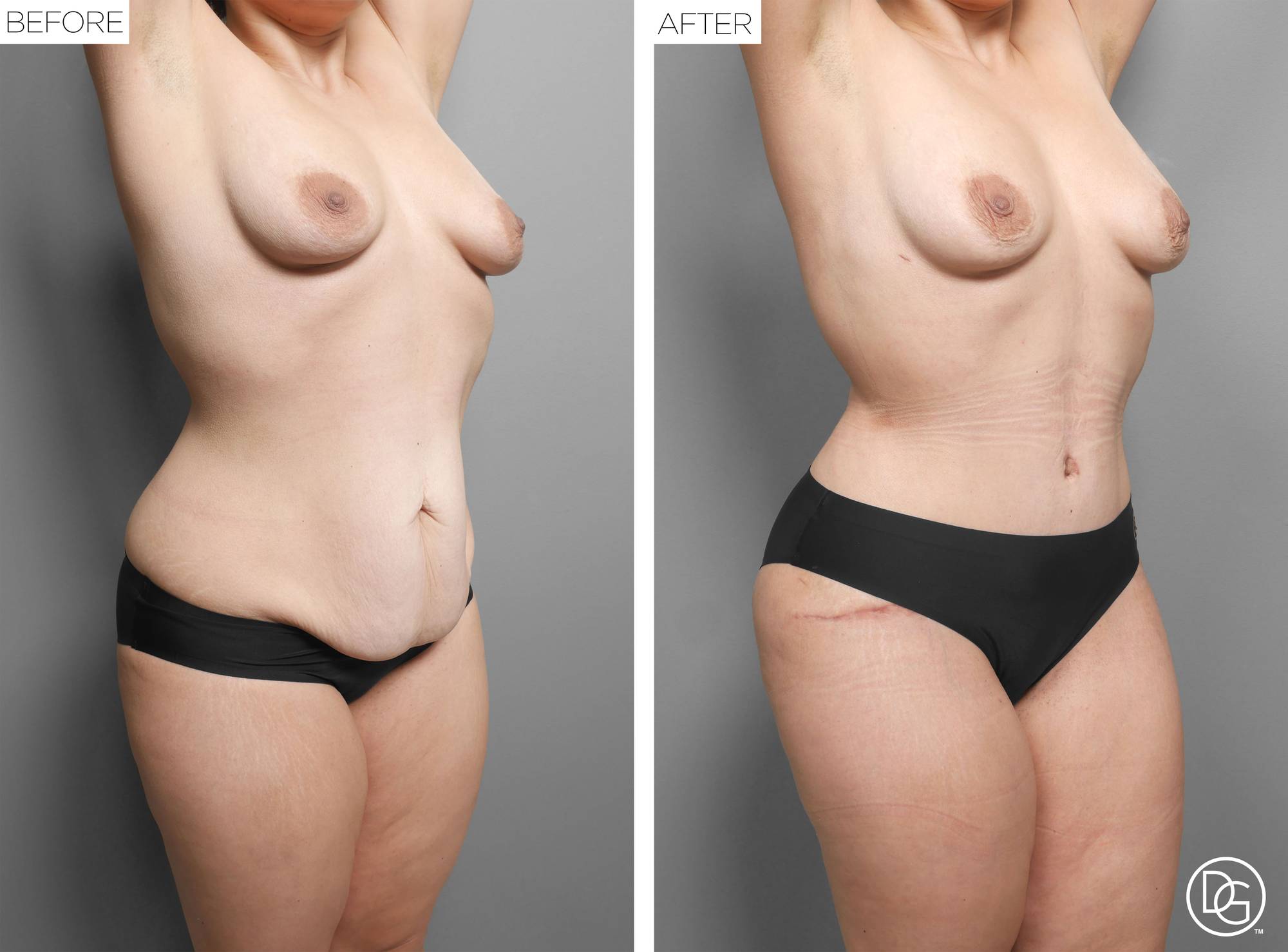 Before & After Image