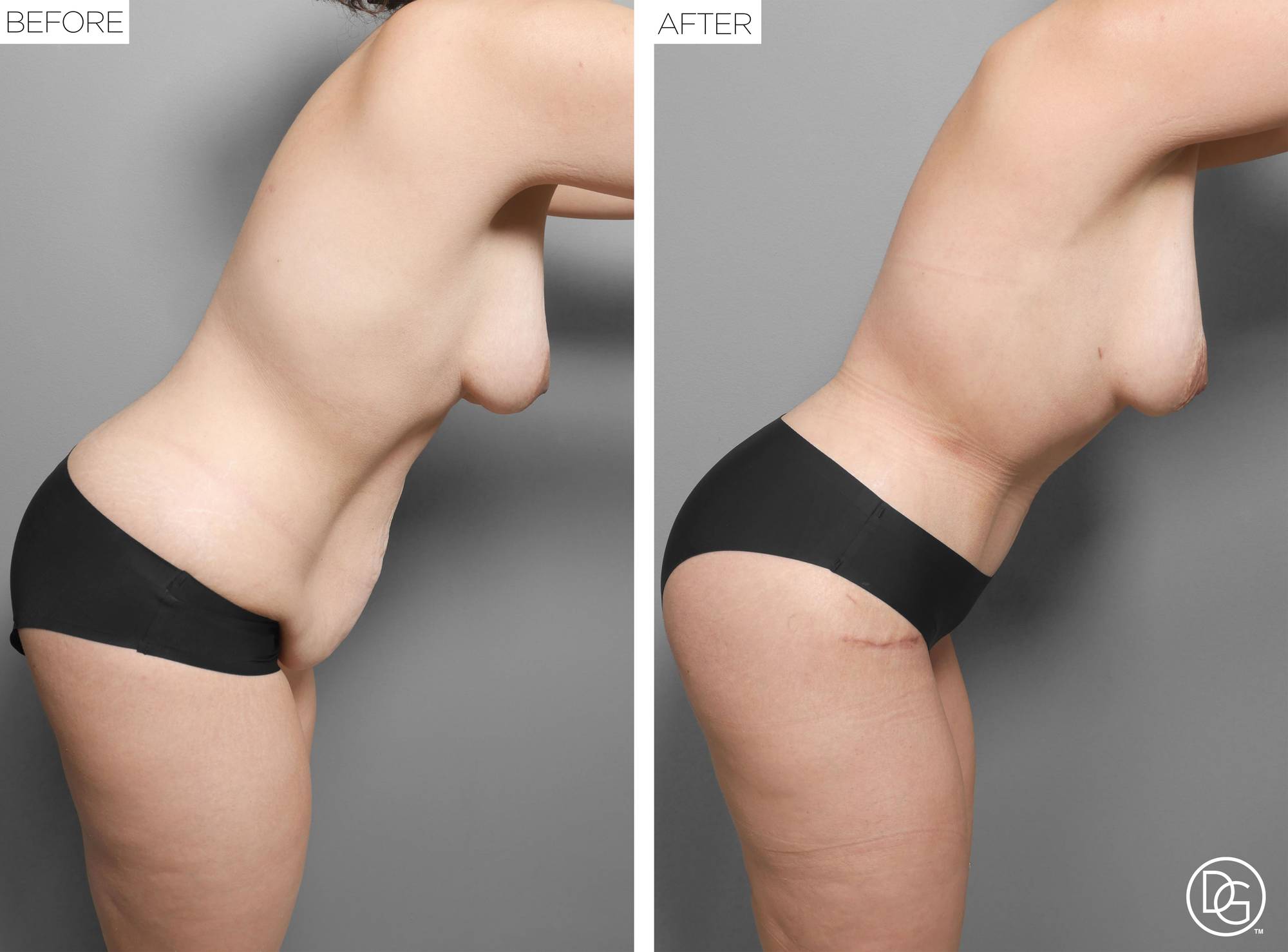 Before & After Image