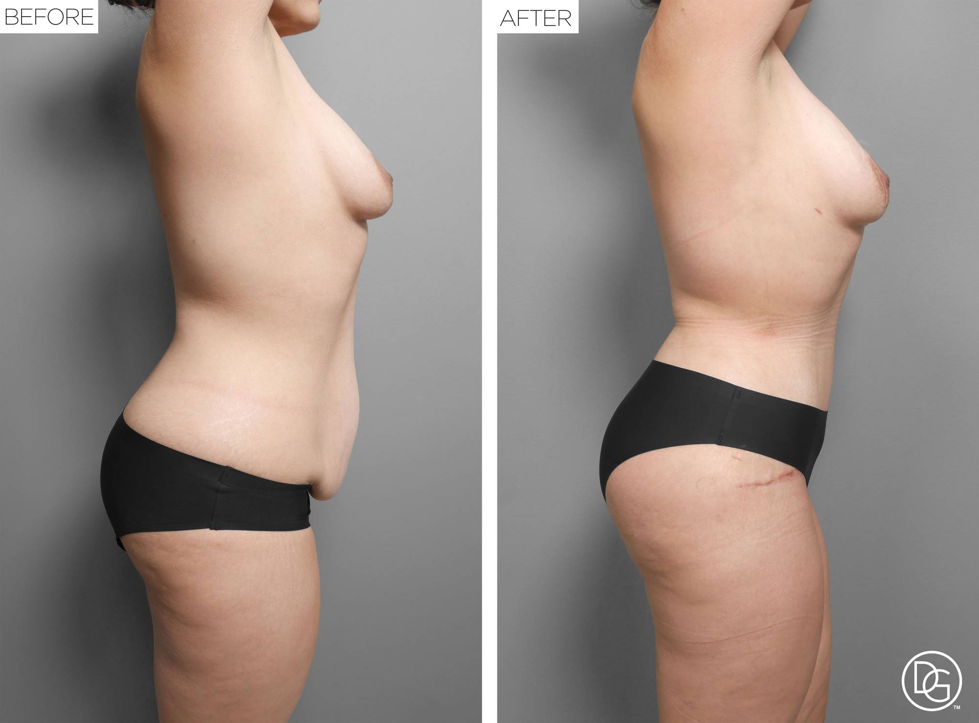 Before & After Image