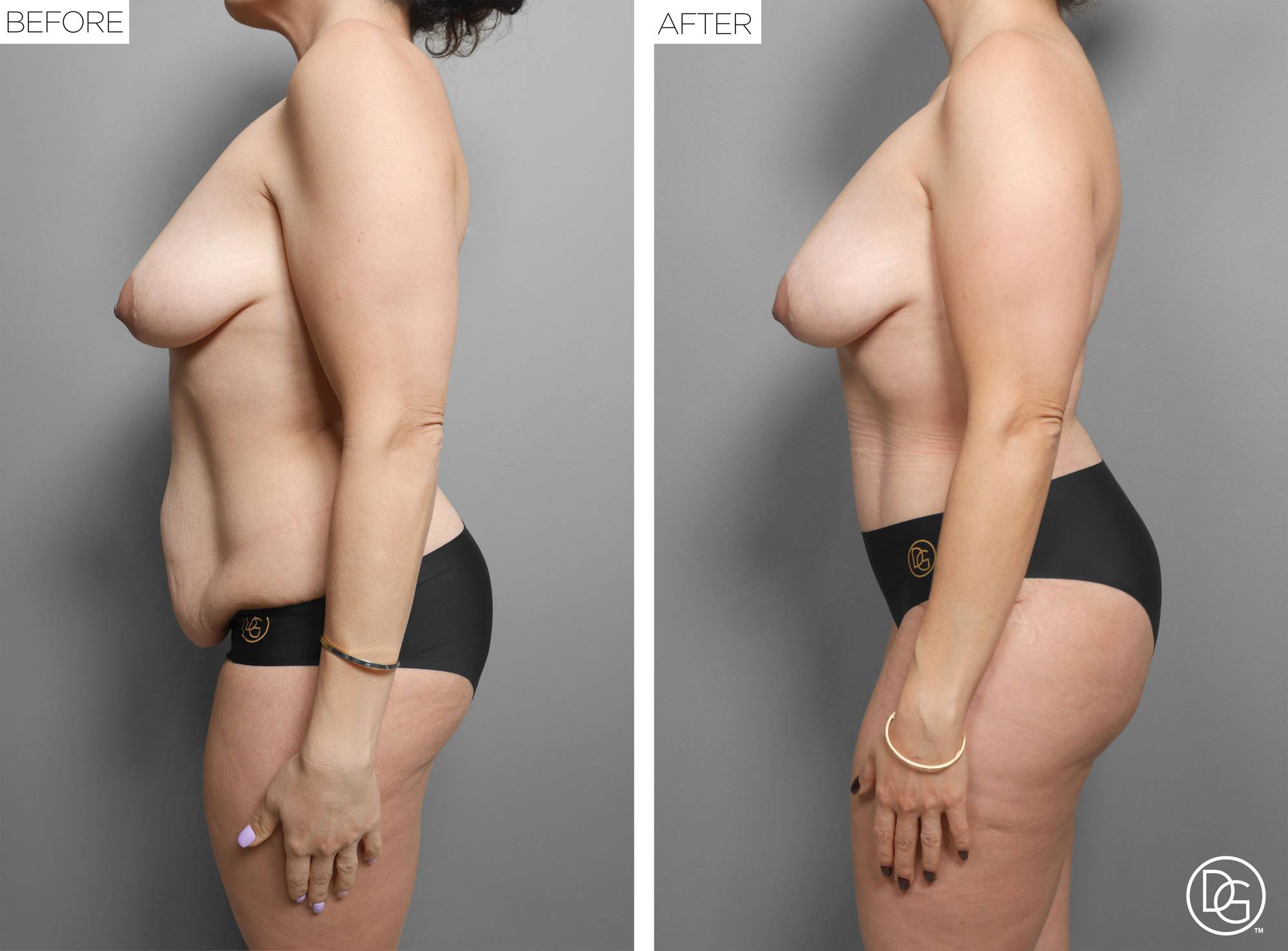 Before & After Image