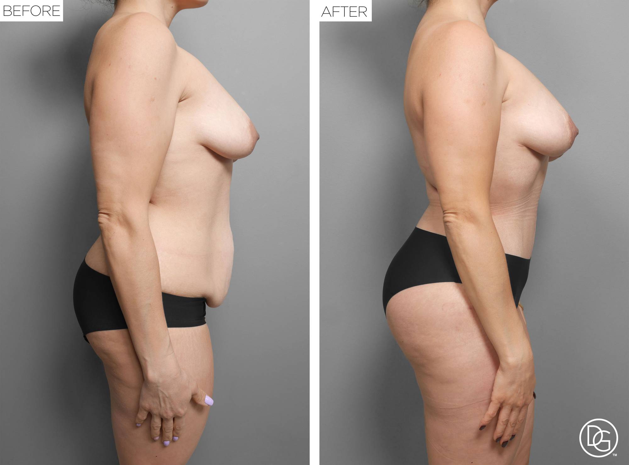 Before & After Image