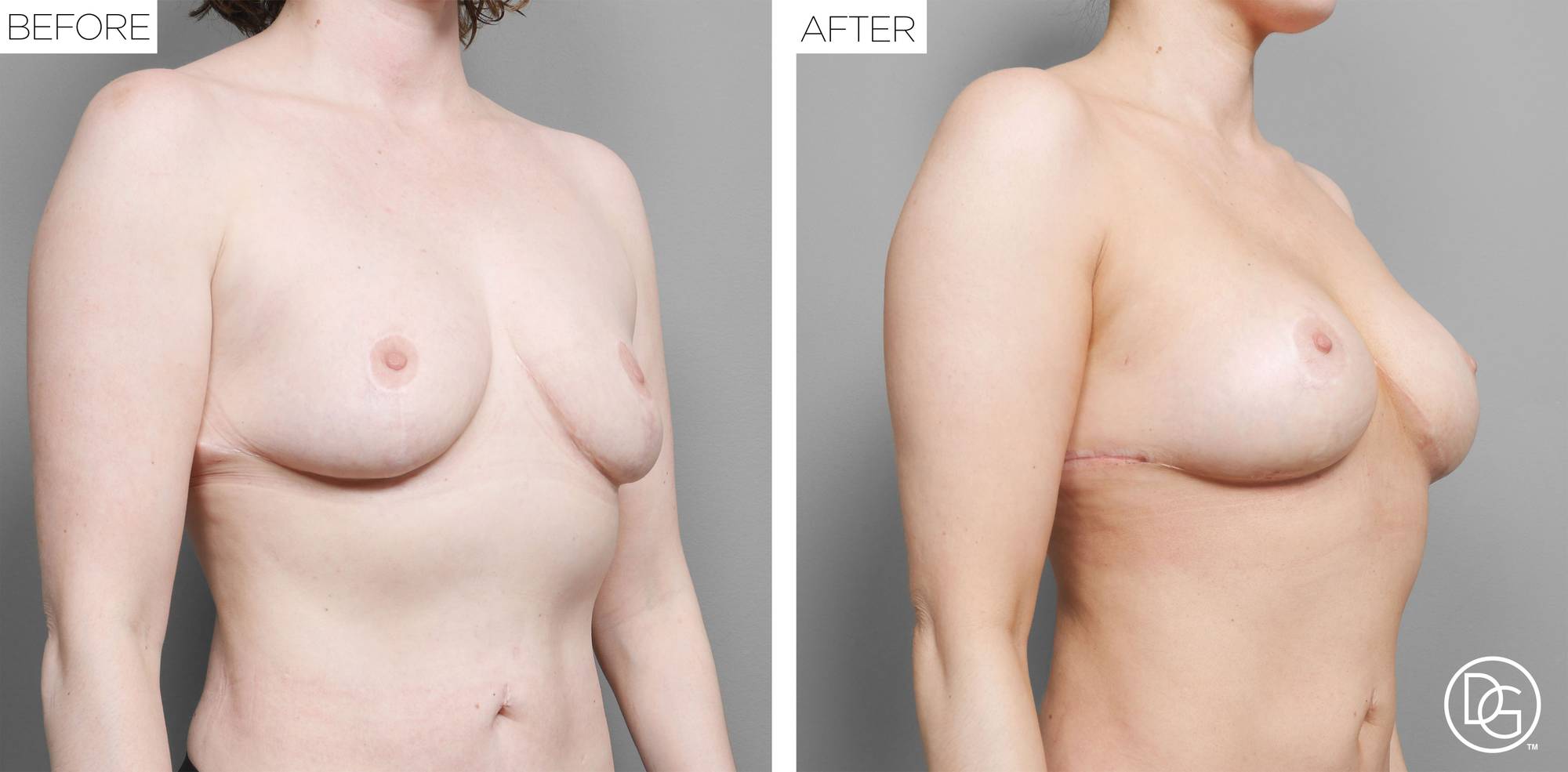 Before & After Image