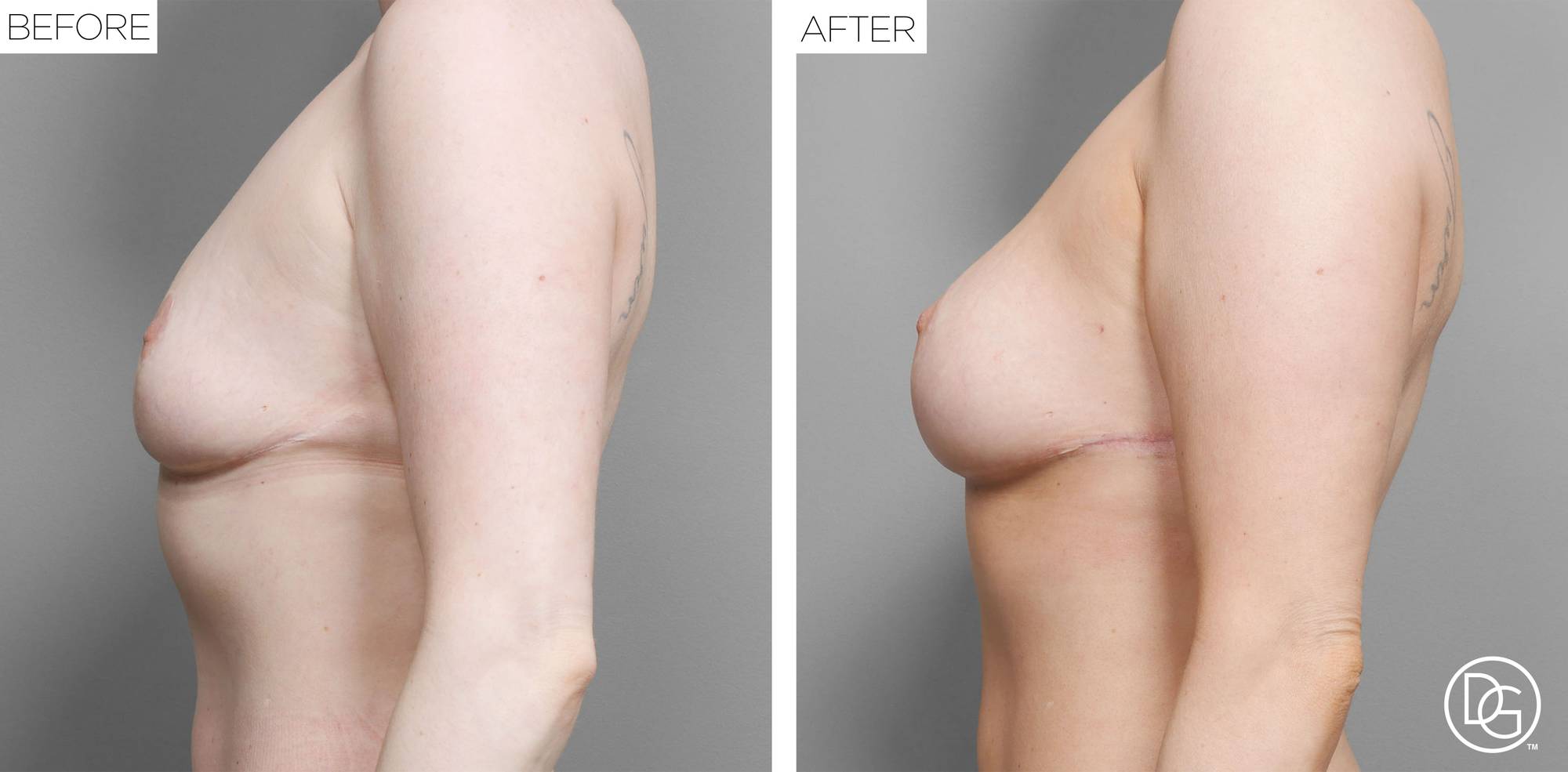 Before & After Image