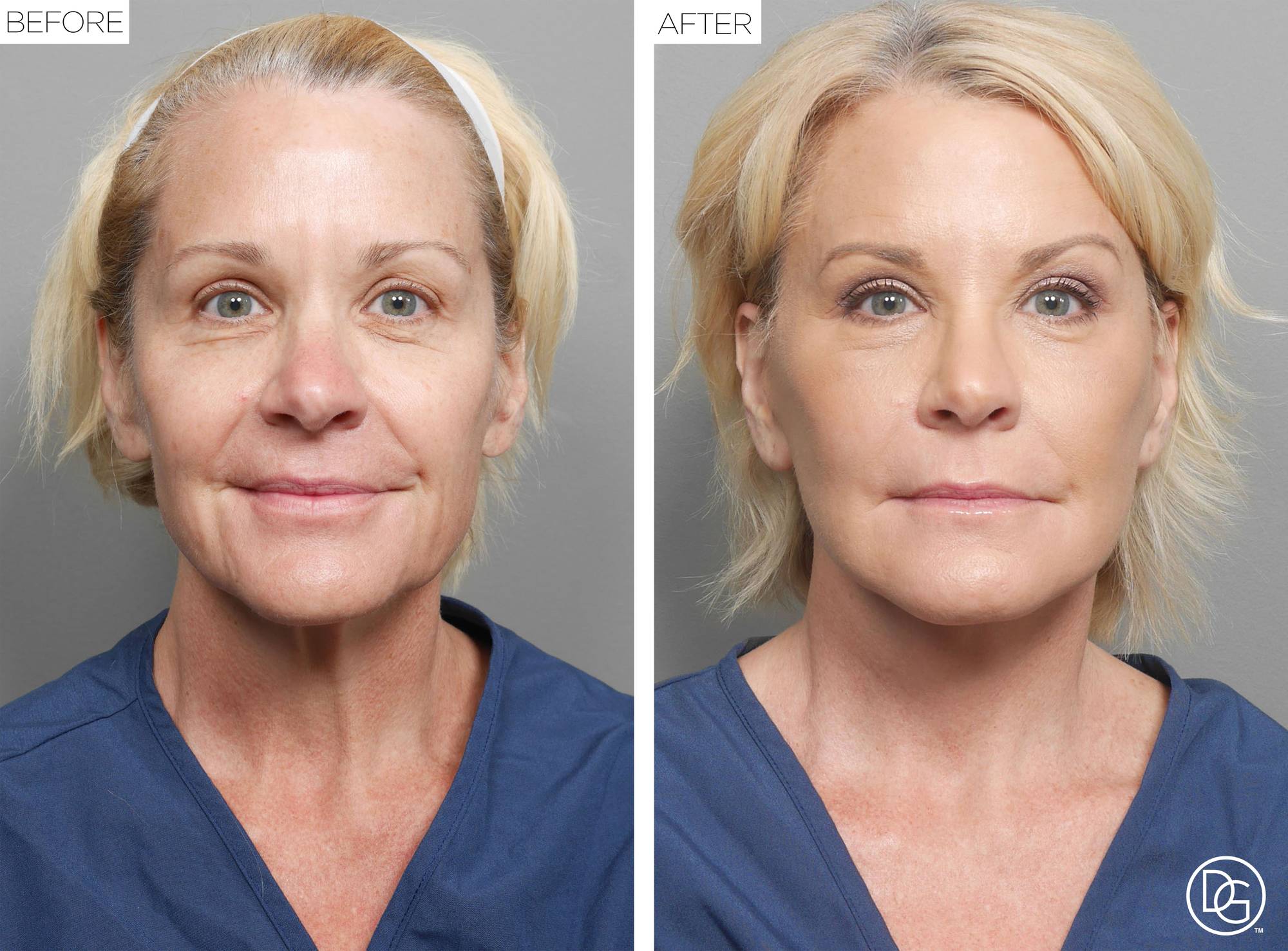Before & After Image