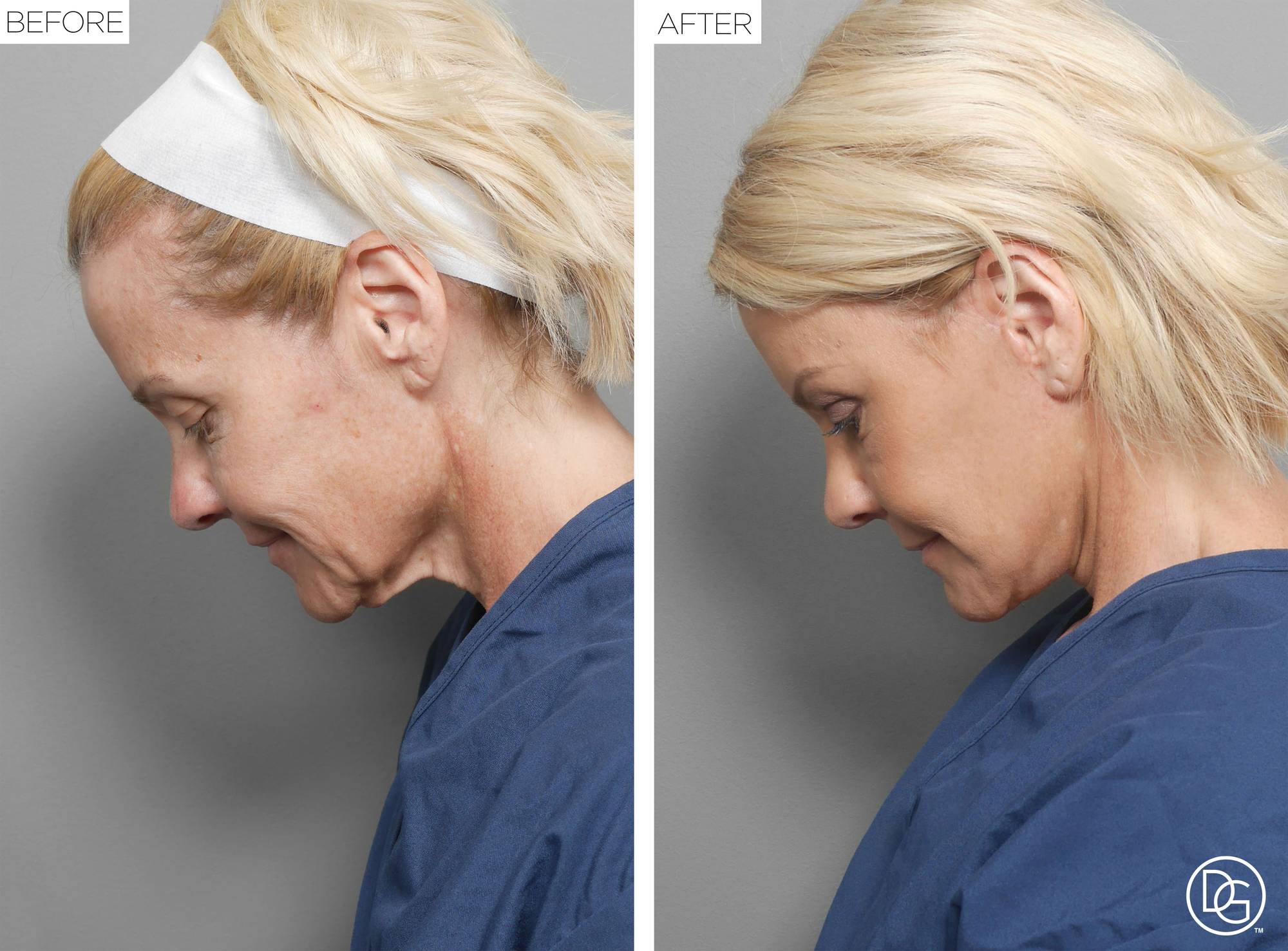 Before & After Image