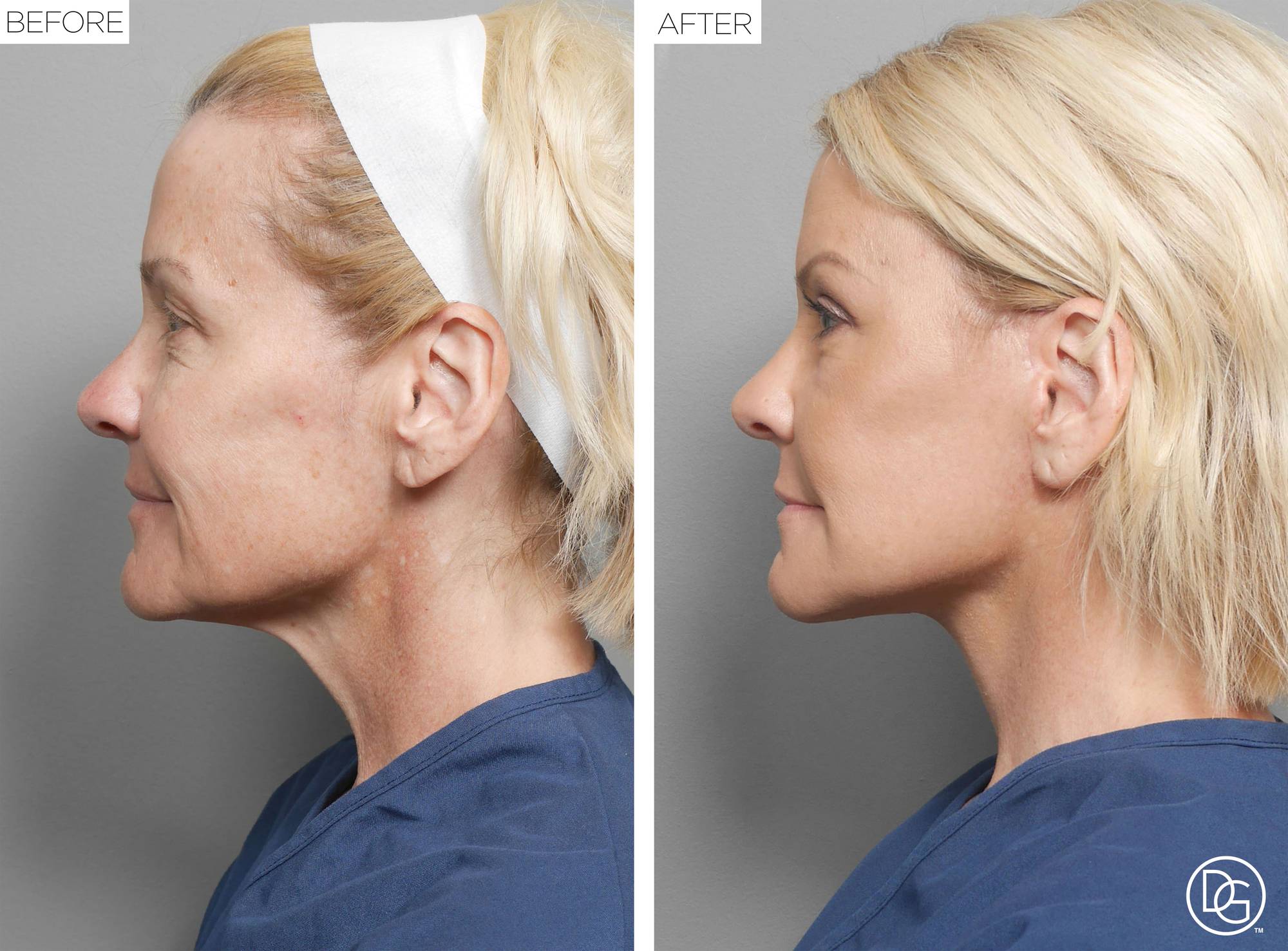 Before & After Image