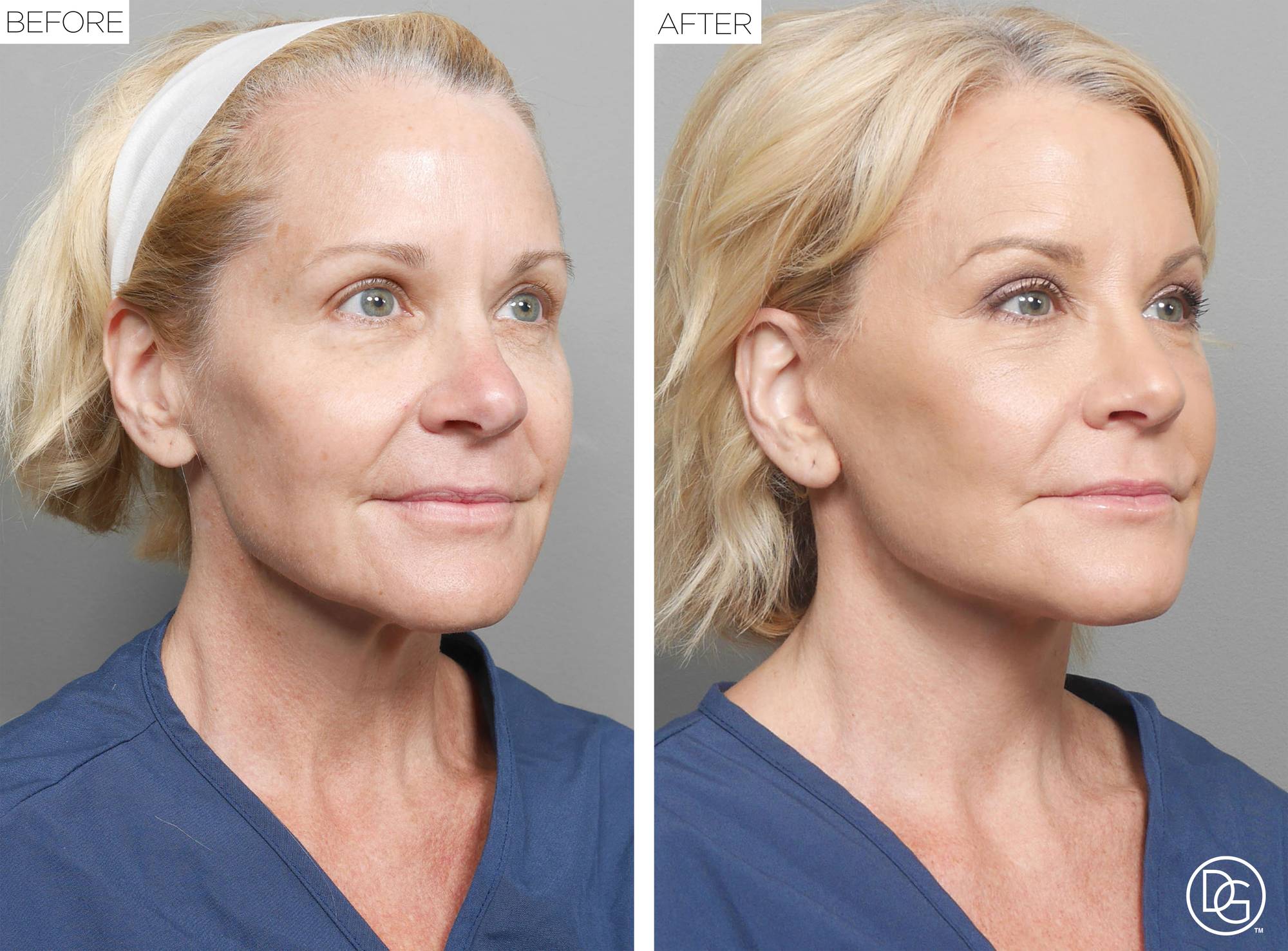 Before & After Image