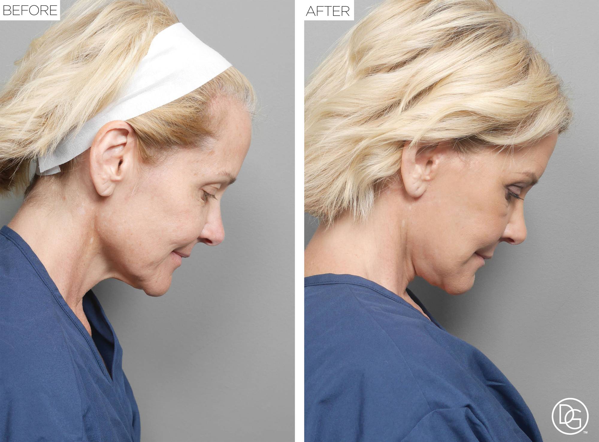 Before & After Image