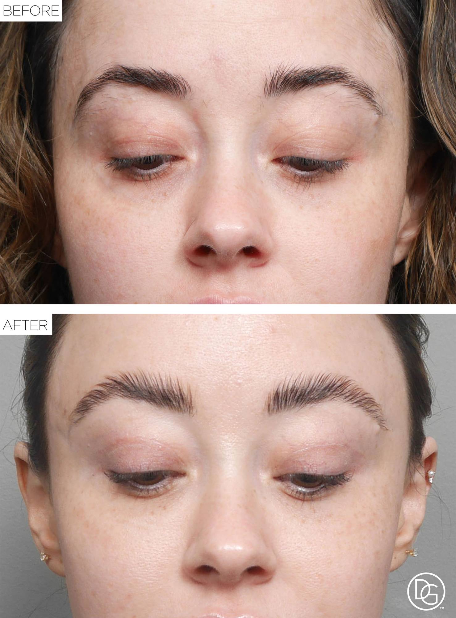 Before & After Image