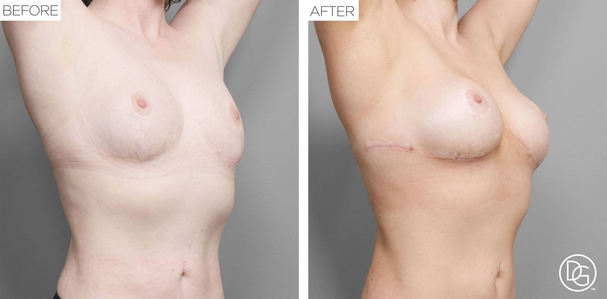 Before & After Image