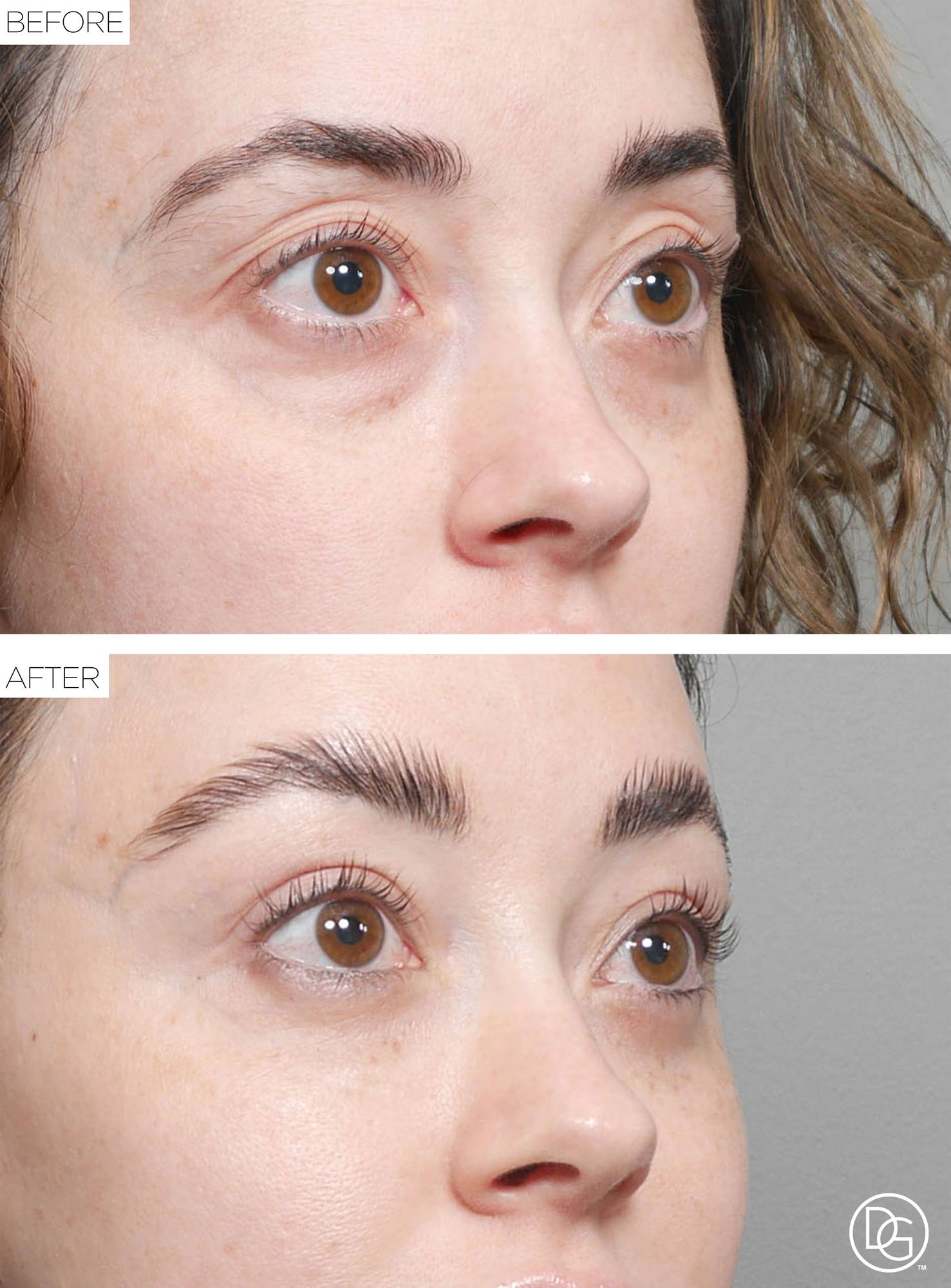 Before & After Image