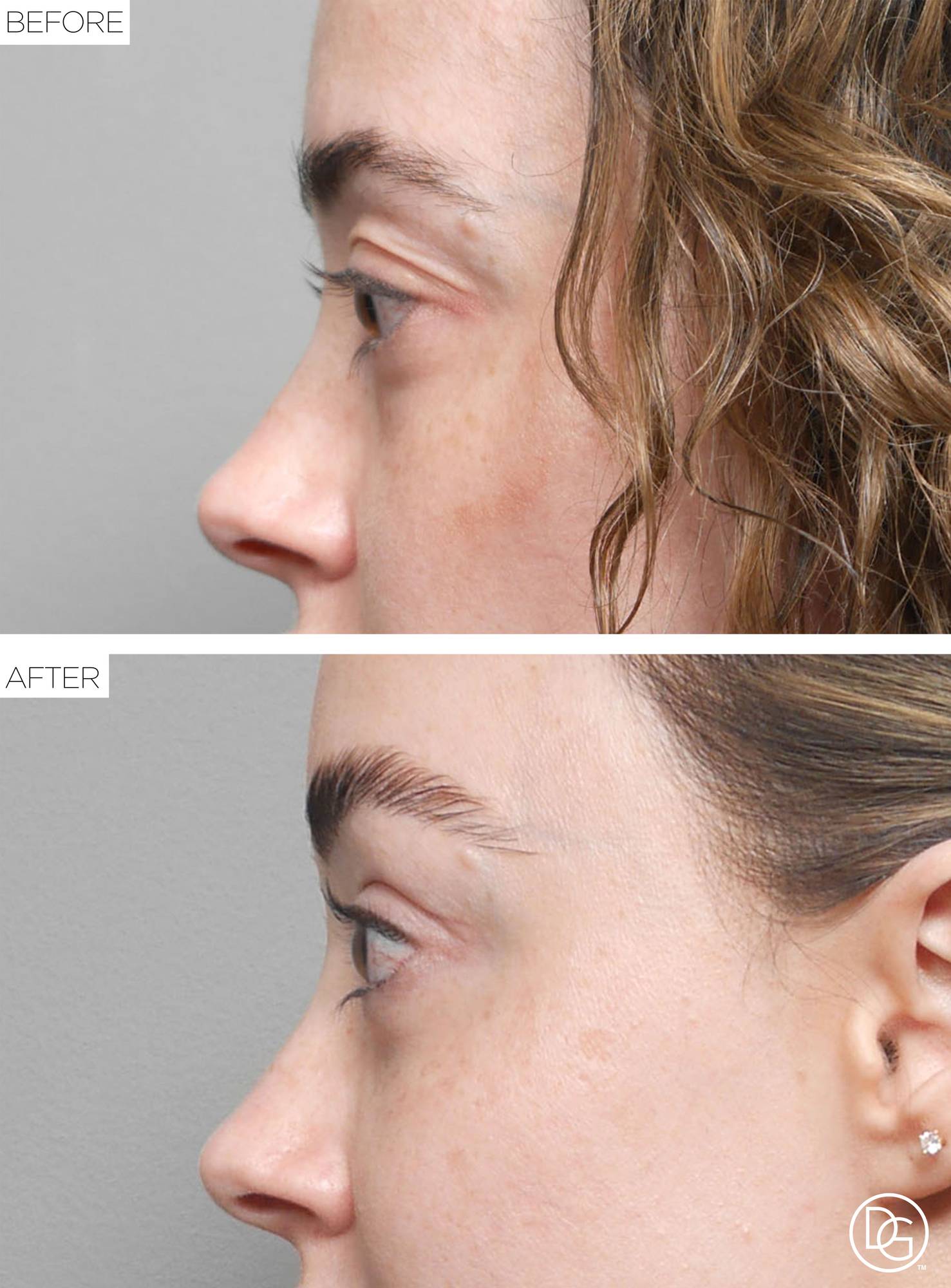 Before & After Image