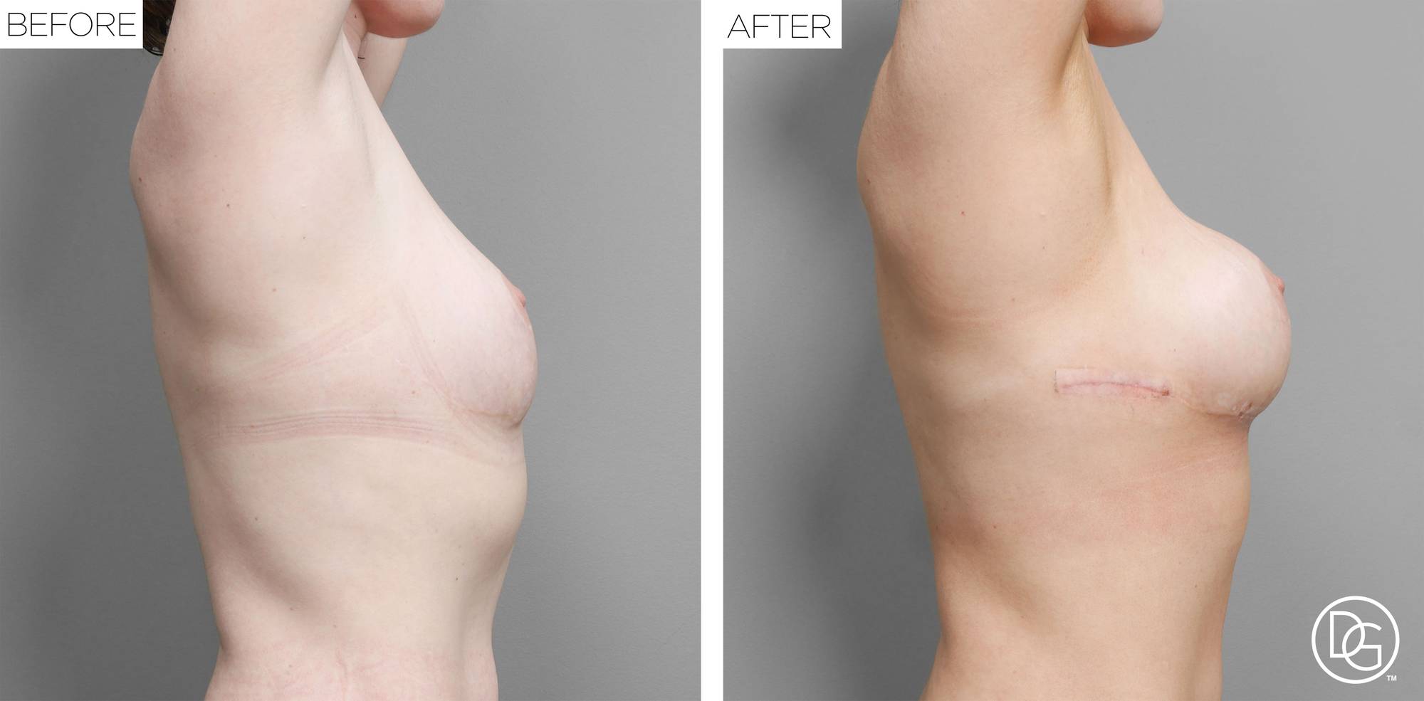 Before & After Image
