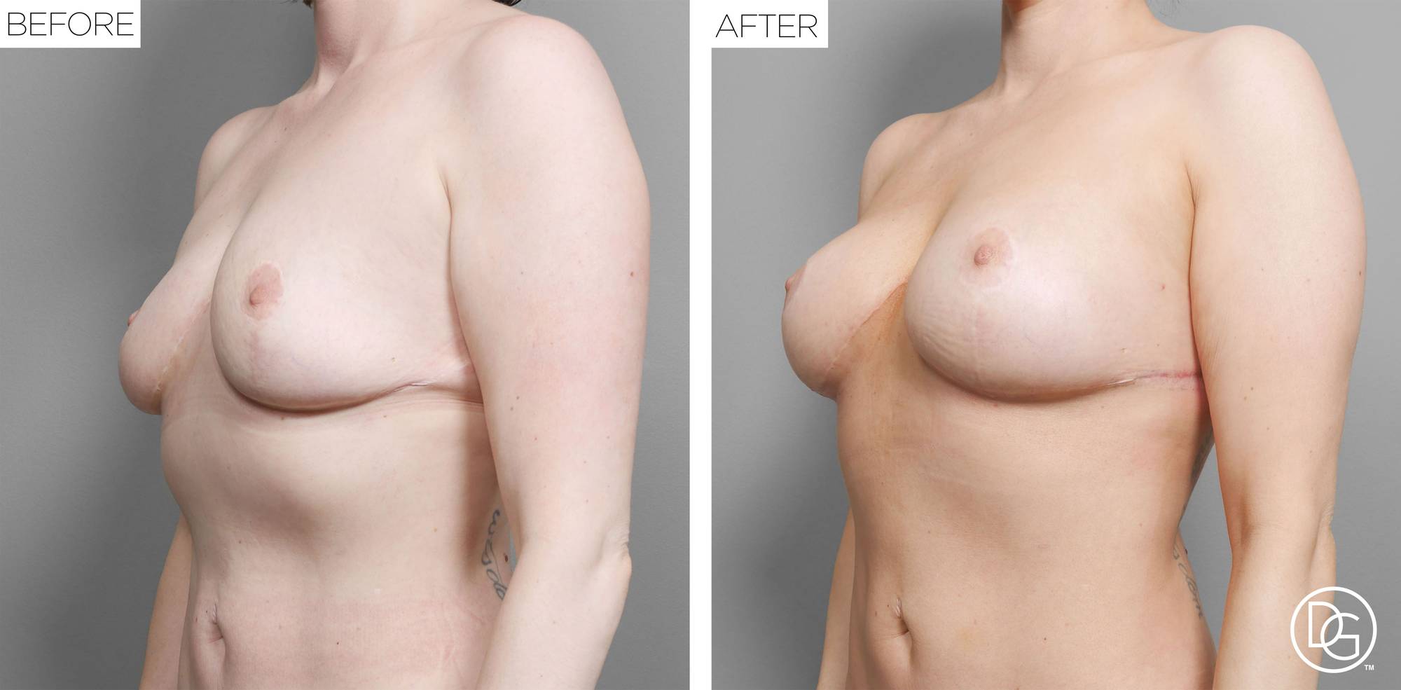 Before & After Image