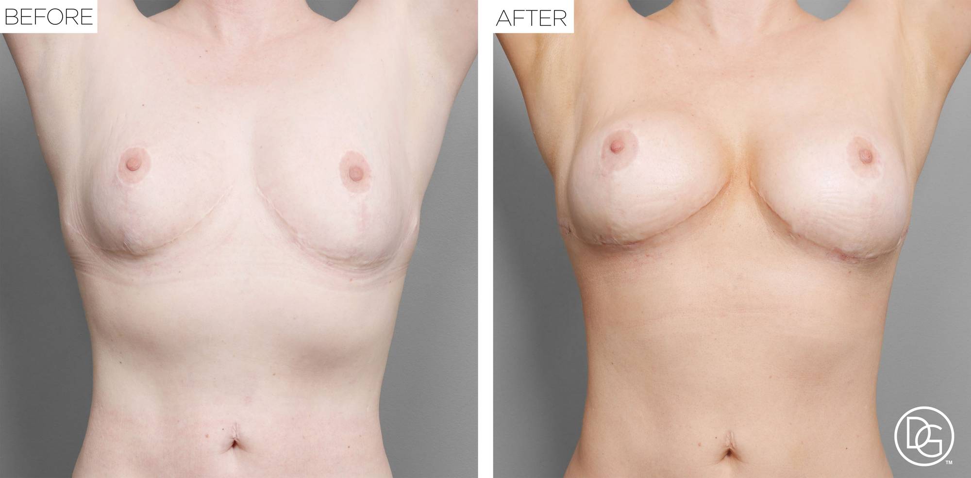 Before & After Image