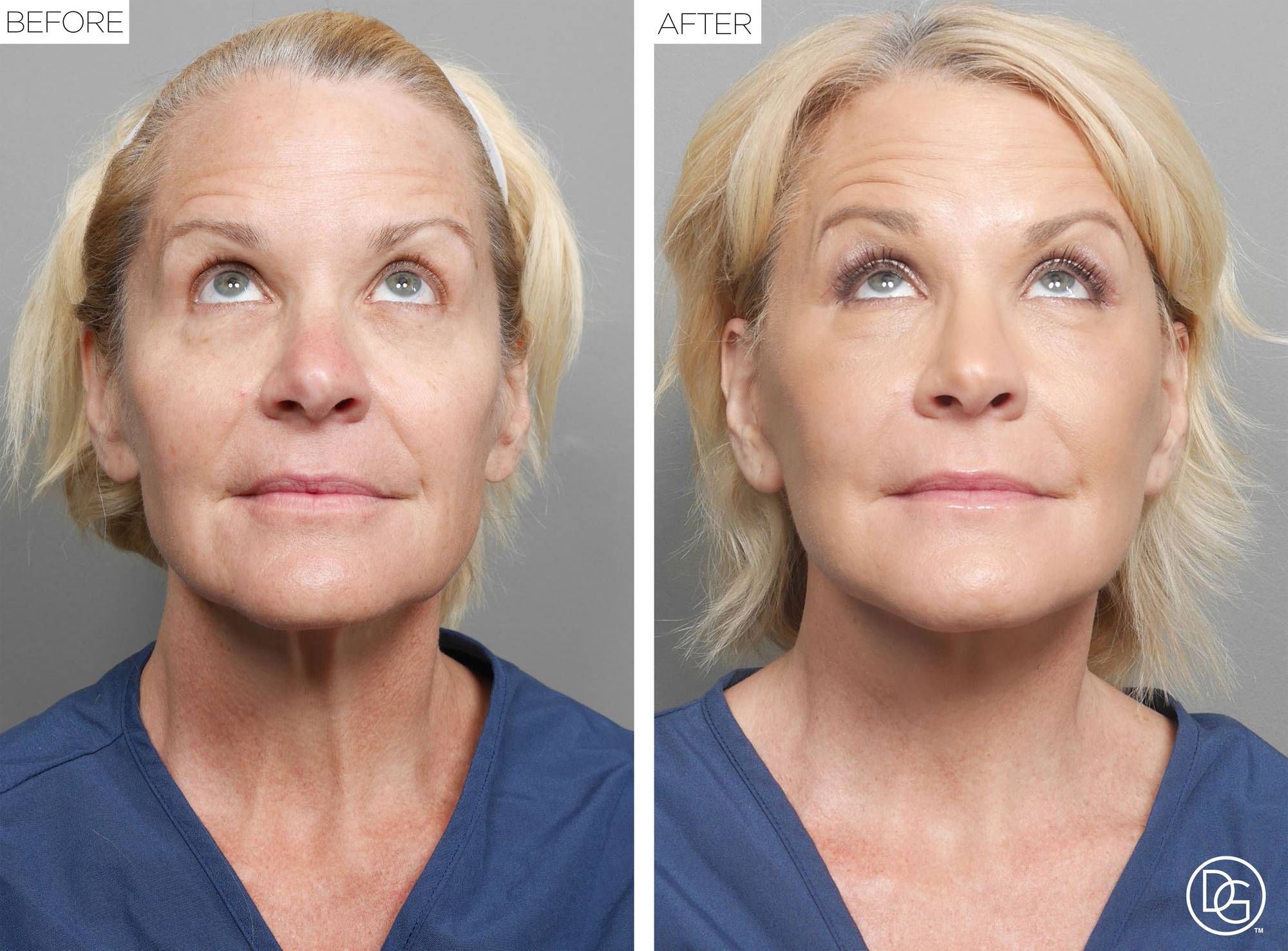 Before & After Image