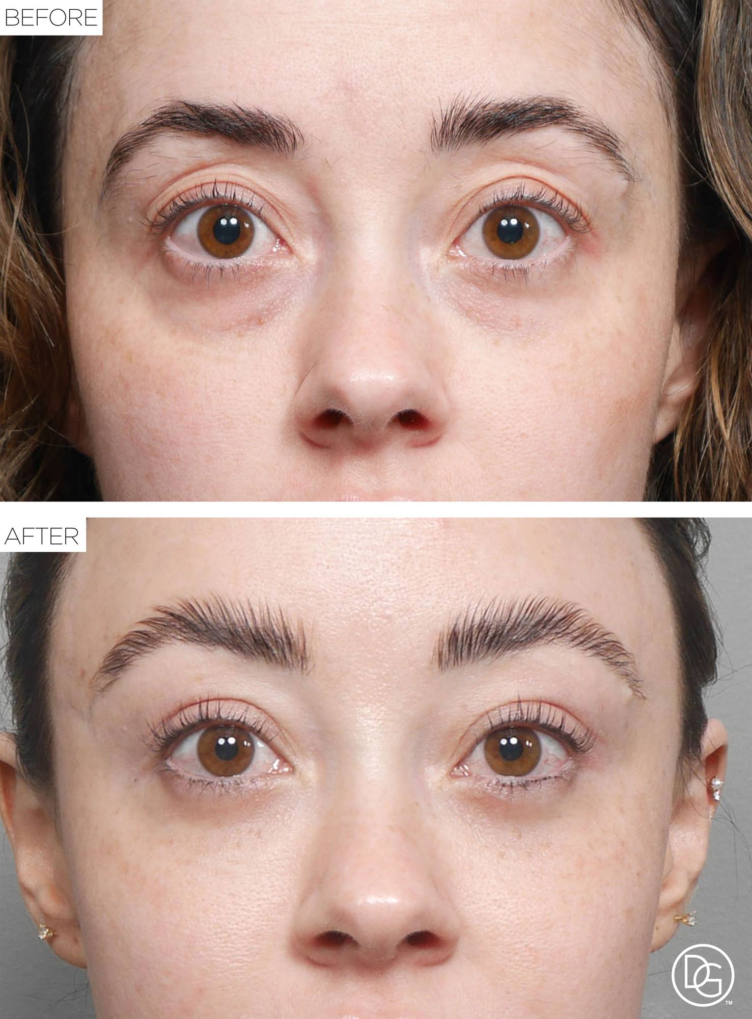 Before & After Image