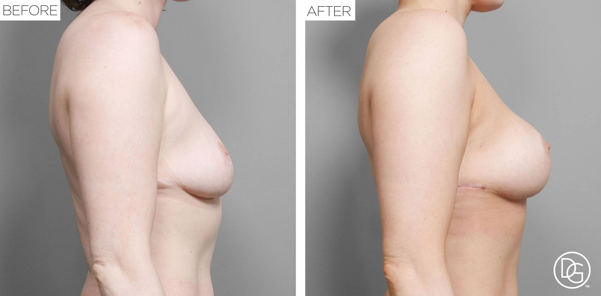 Before & After Image