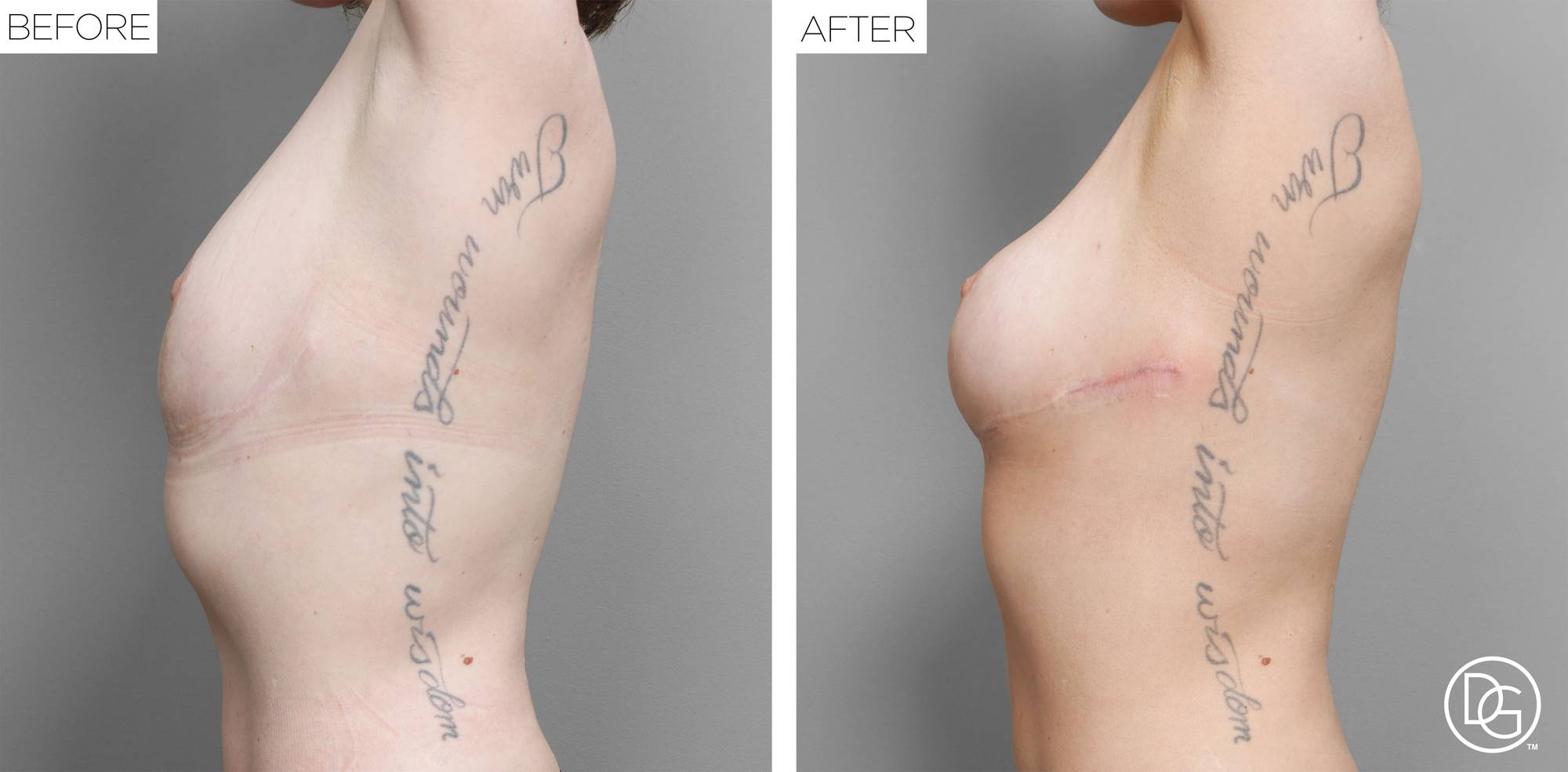 Before & After Image