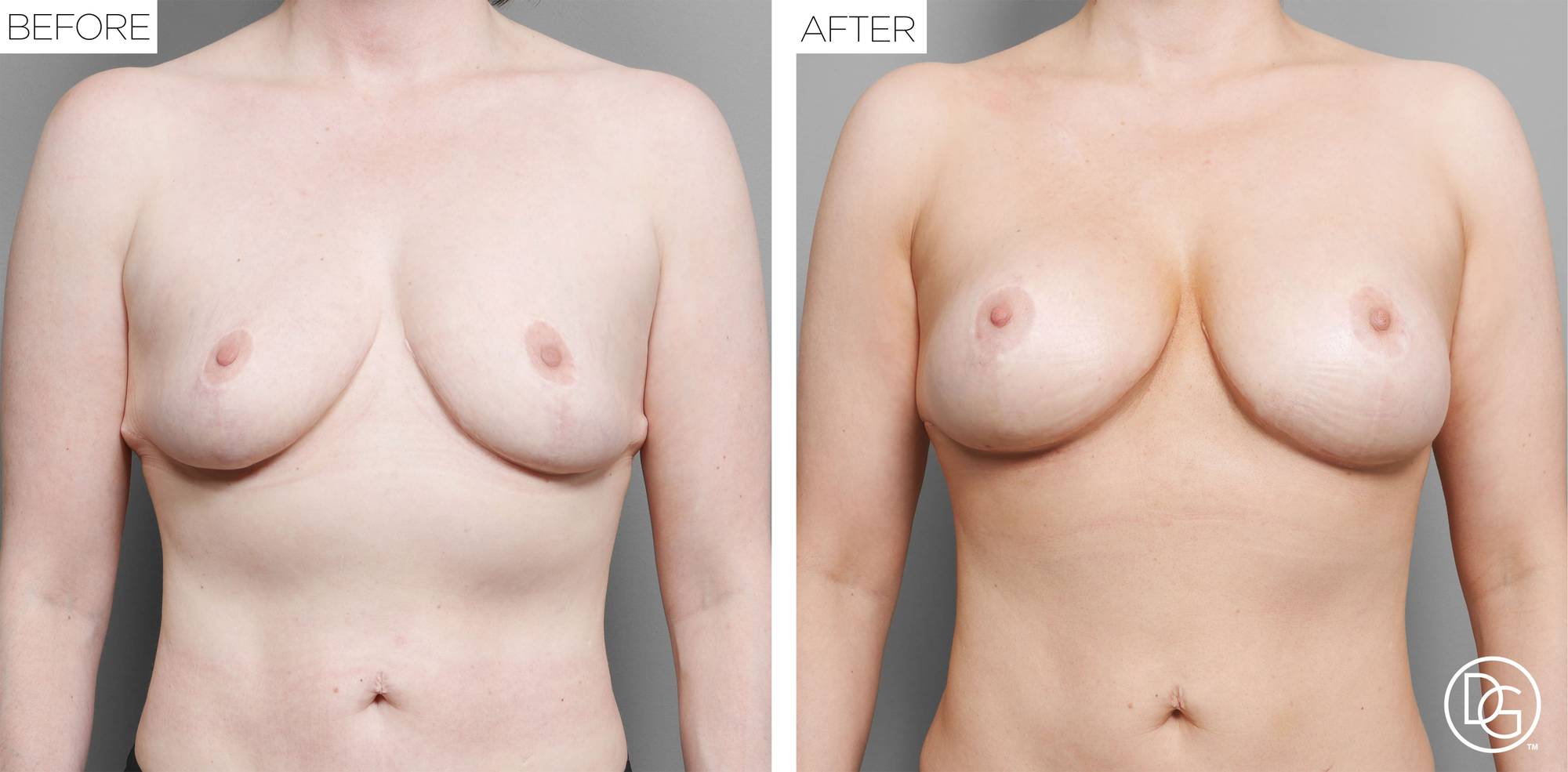 Before & After Image