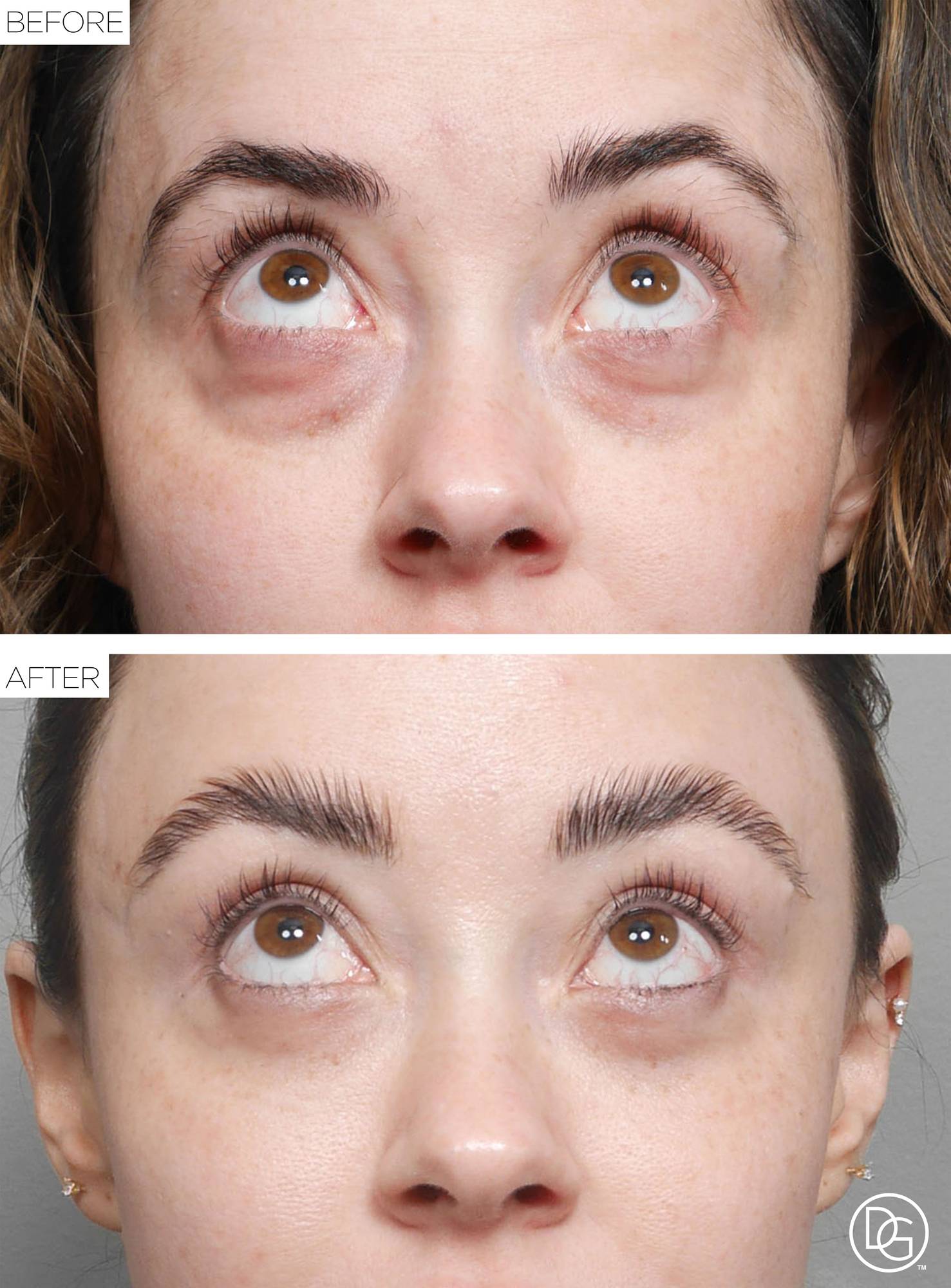 Before & After Image