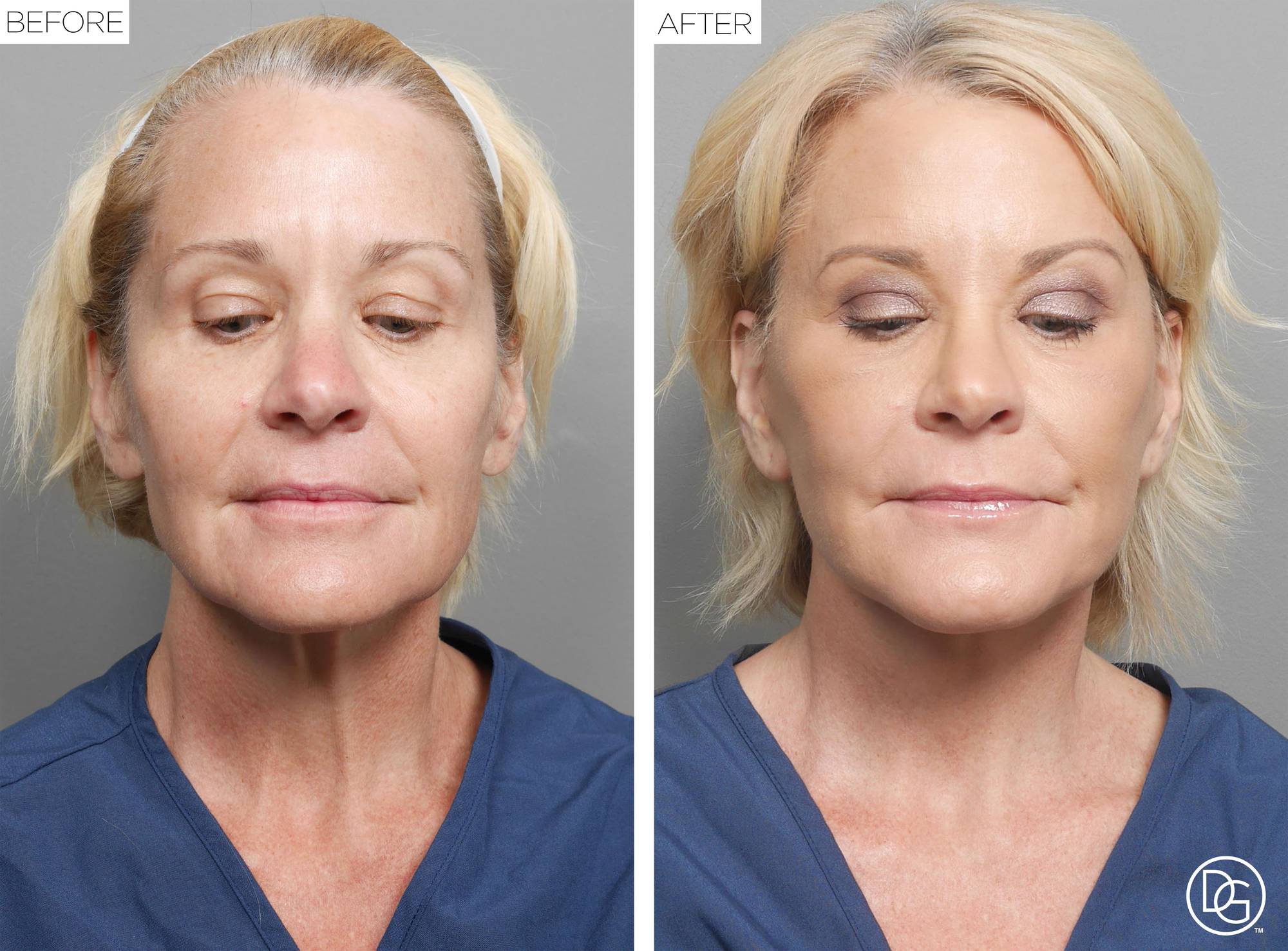 Before & After Image