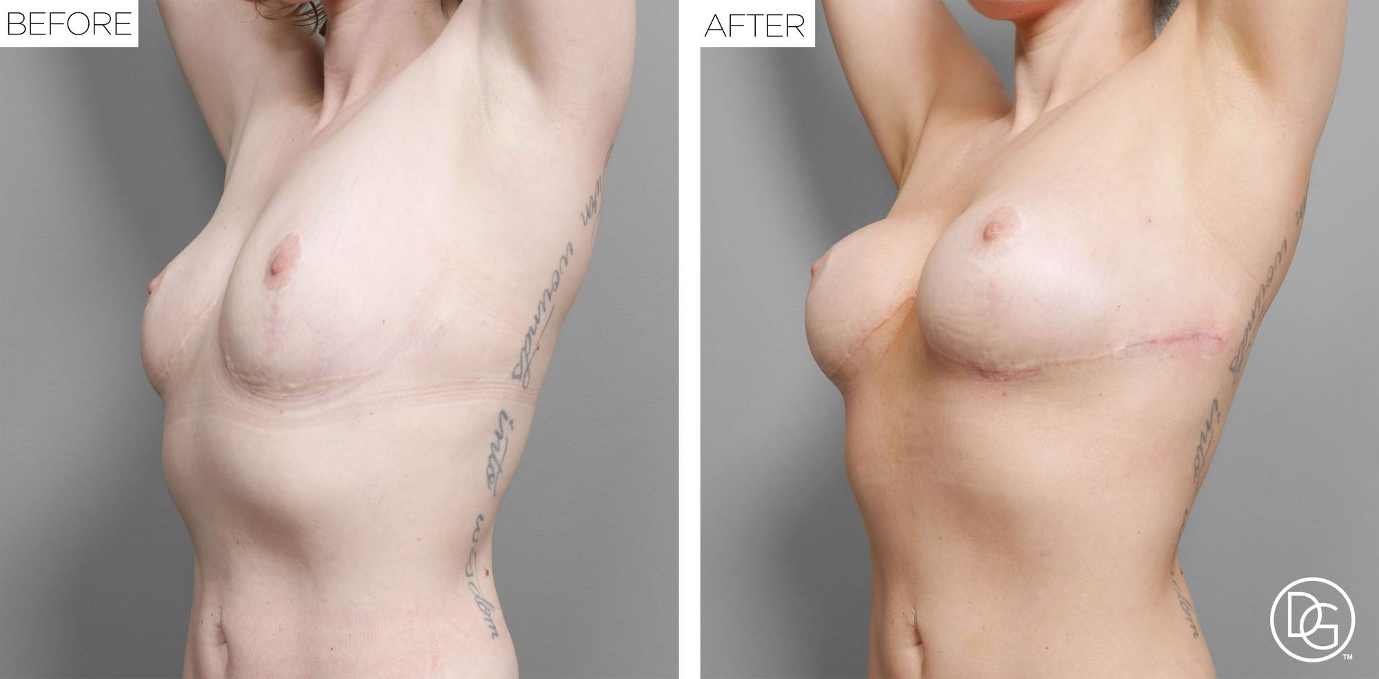 Before & After Image