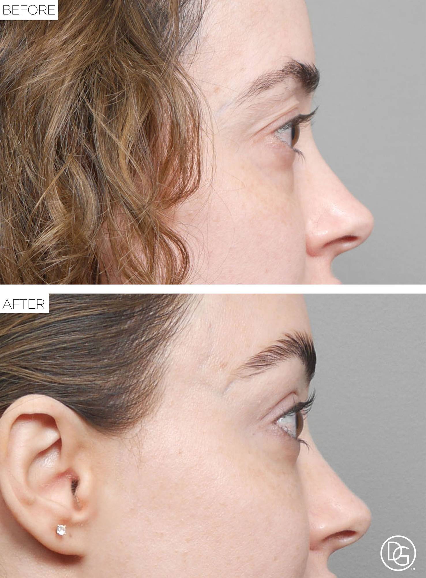 Before & After Image