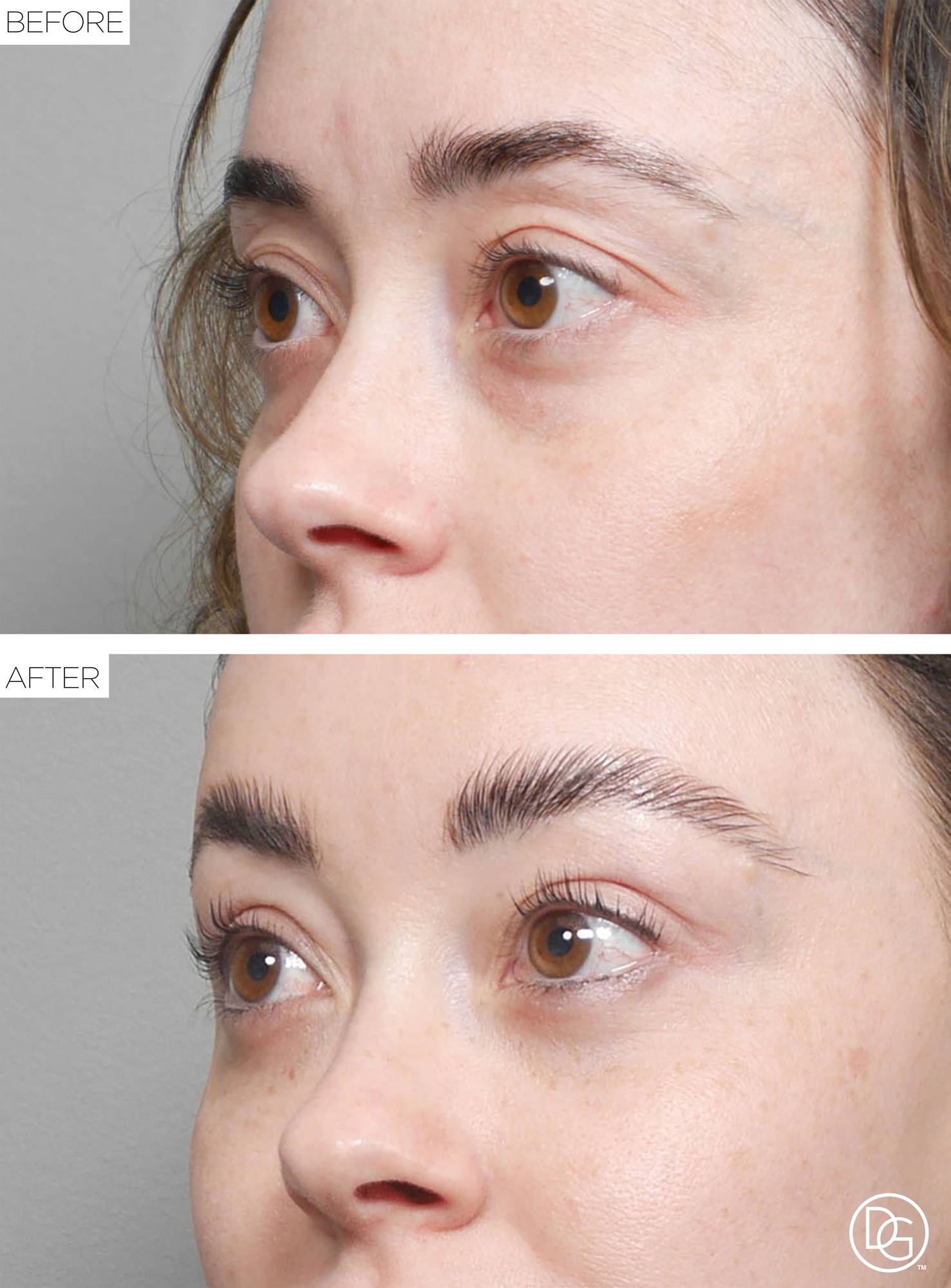 Before & After Image