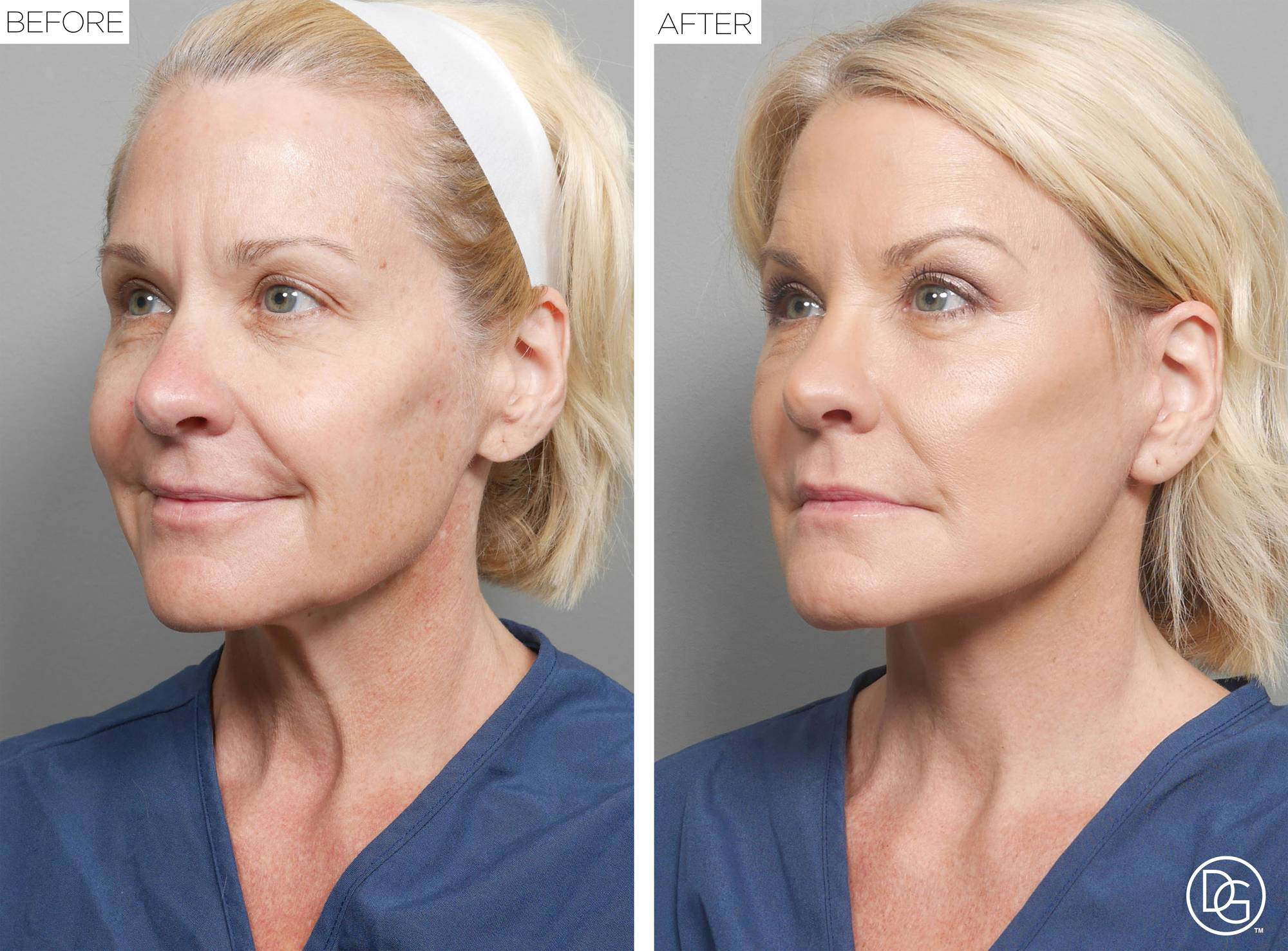 Before & After Image