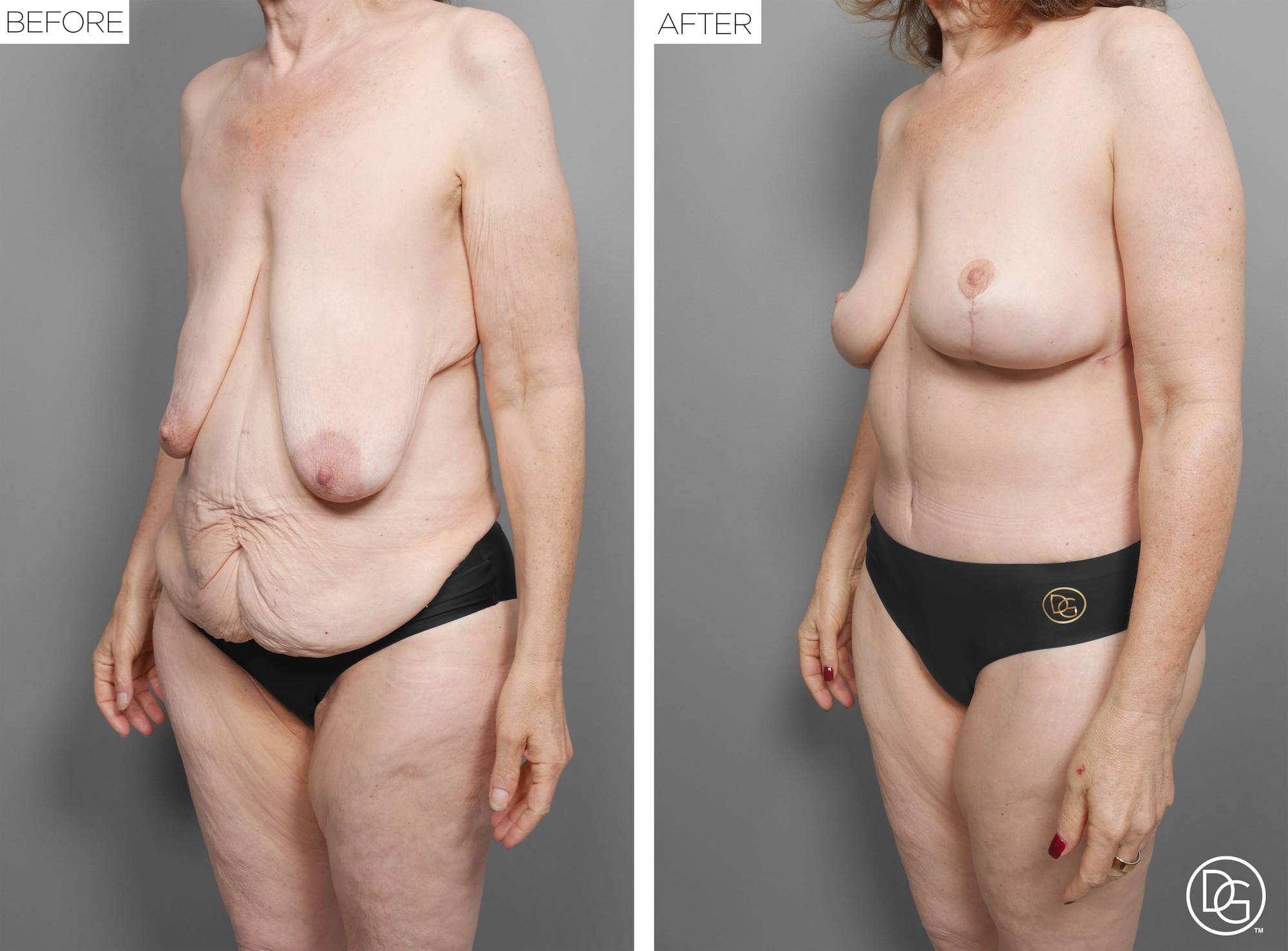 Before & After Image
