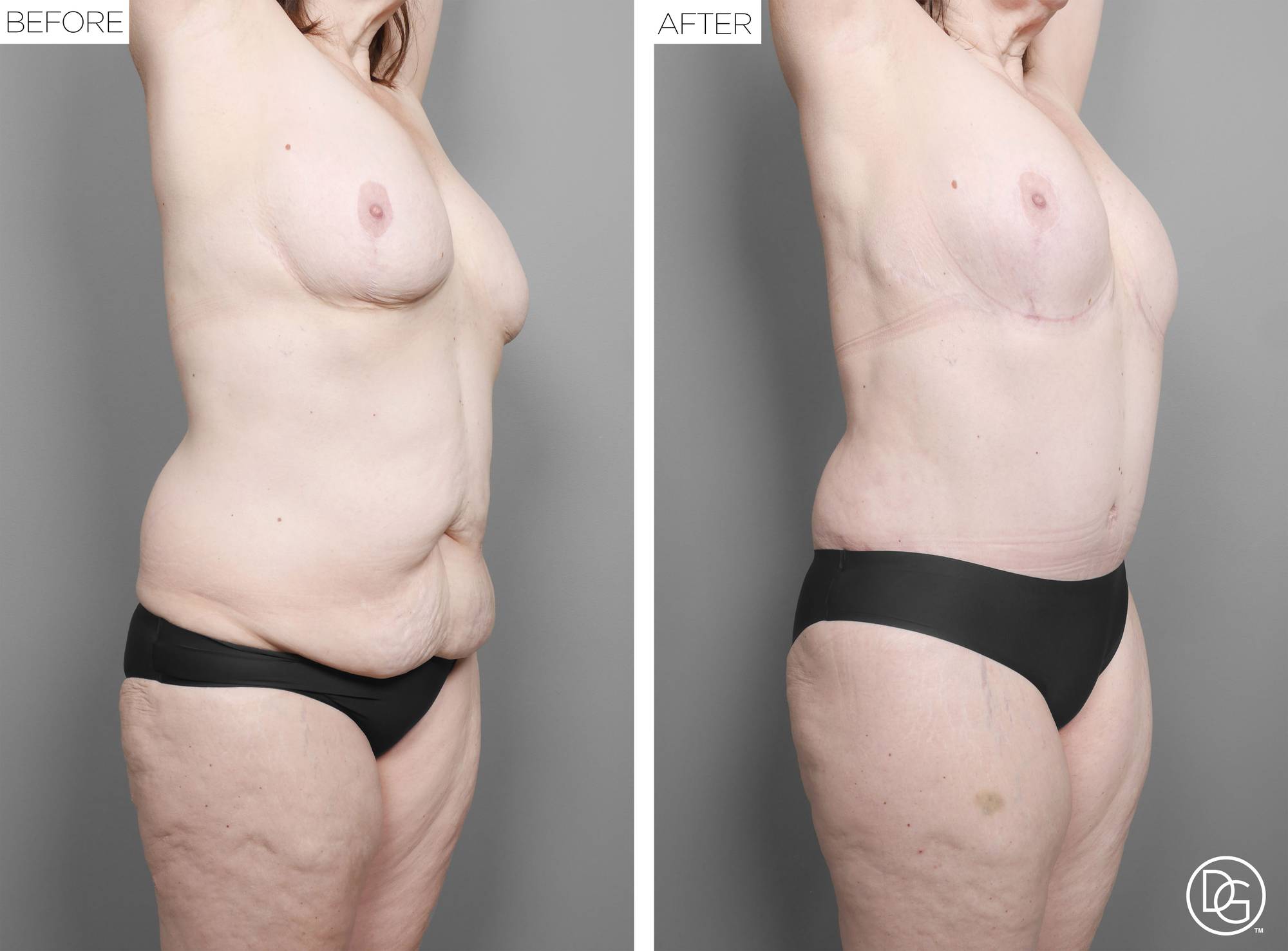 Before & After Image